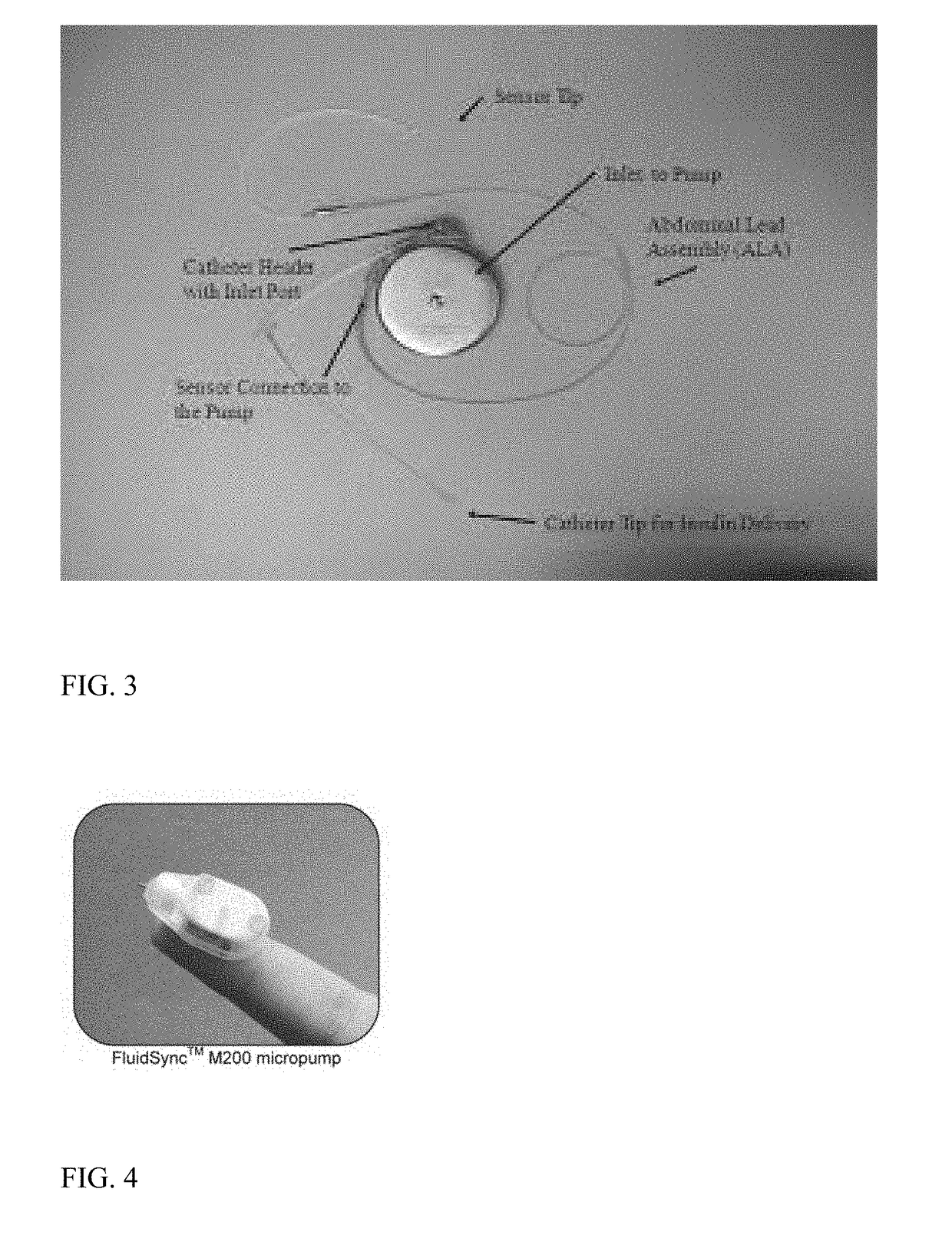 Bioelectric stimulator