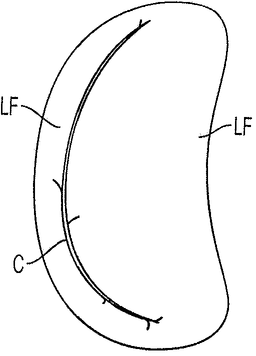 Independent gripper