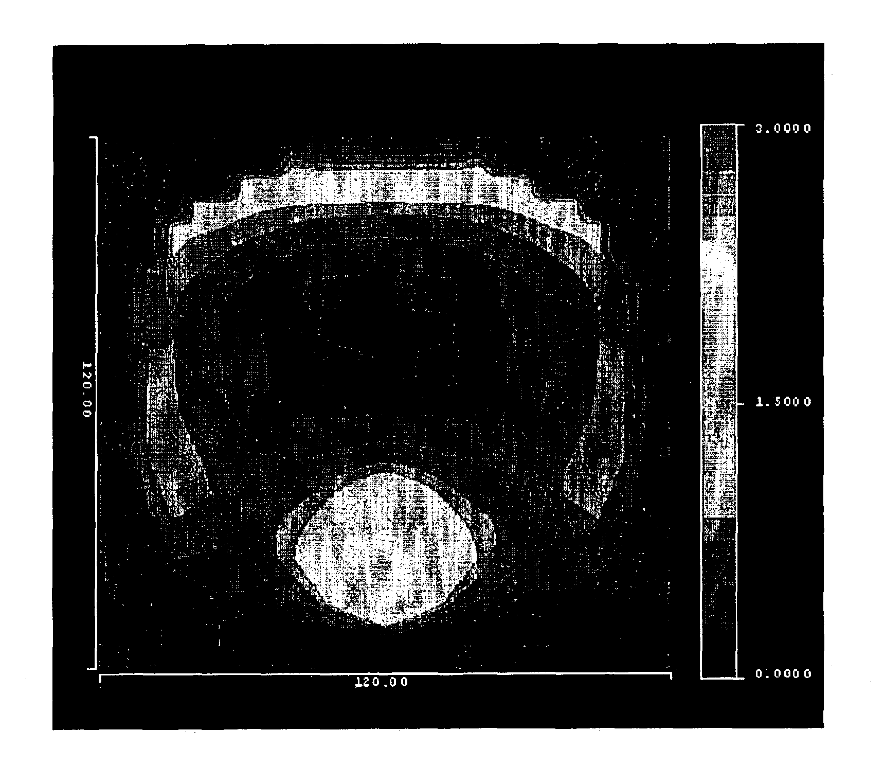 Method for designing progressive addition lenses