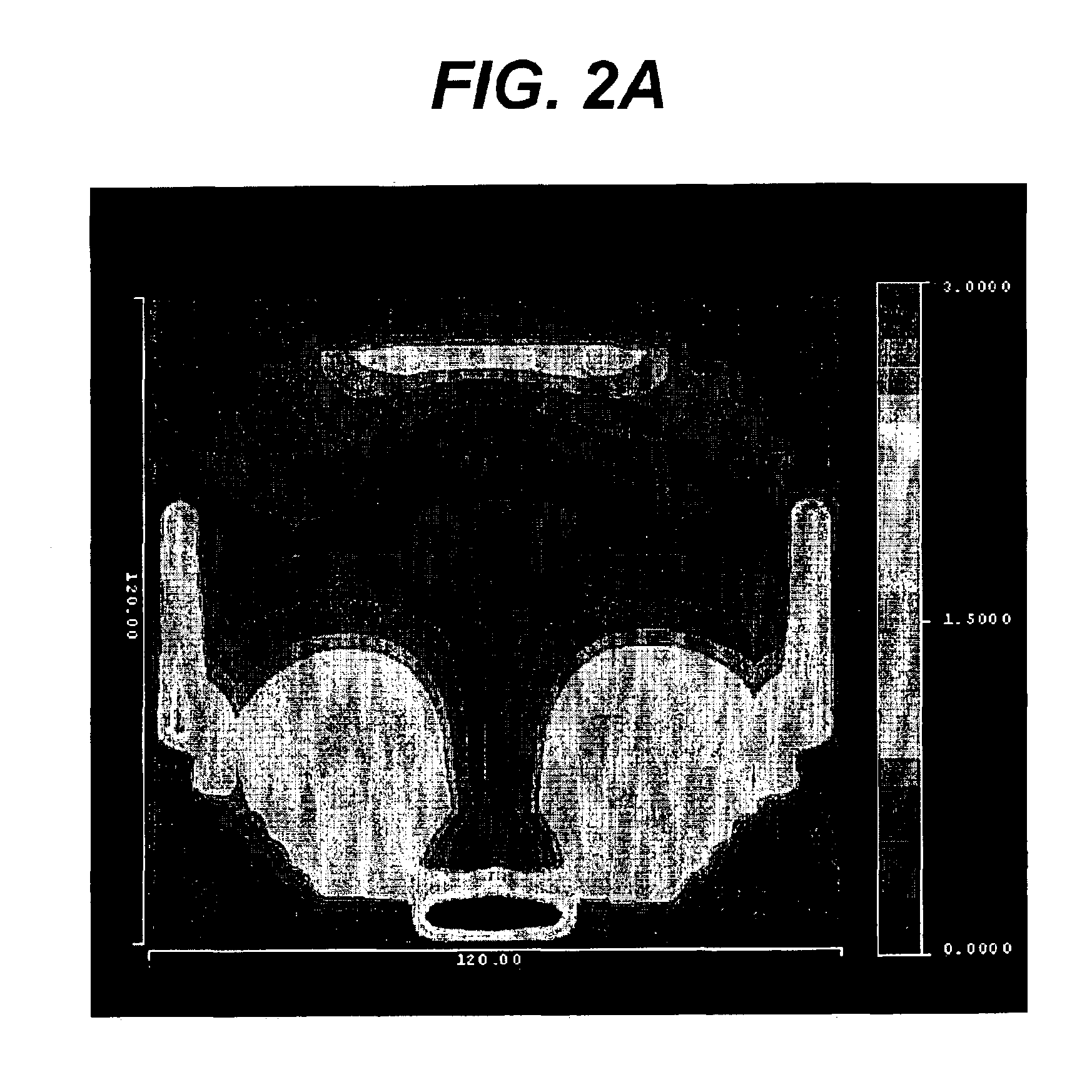 Method for designing progressive addition lenses