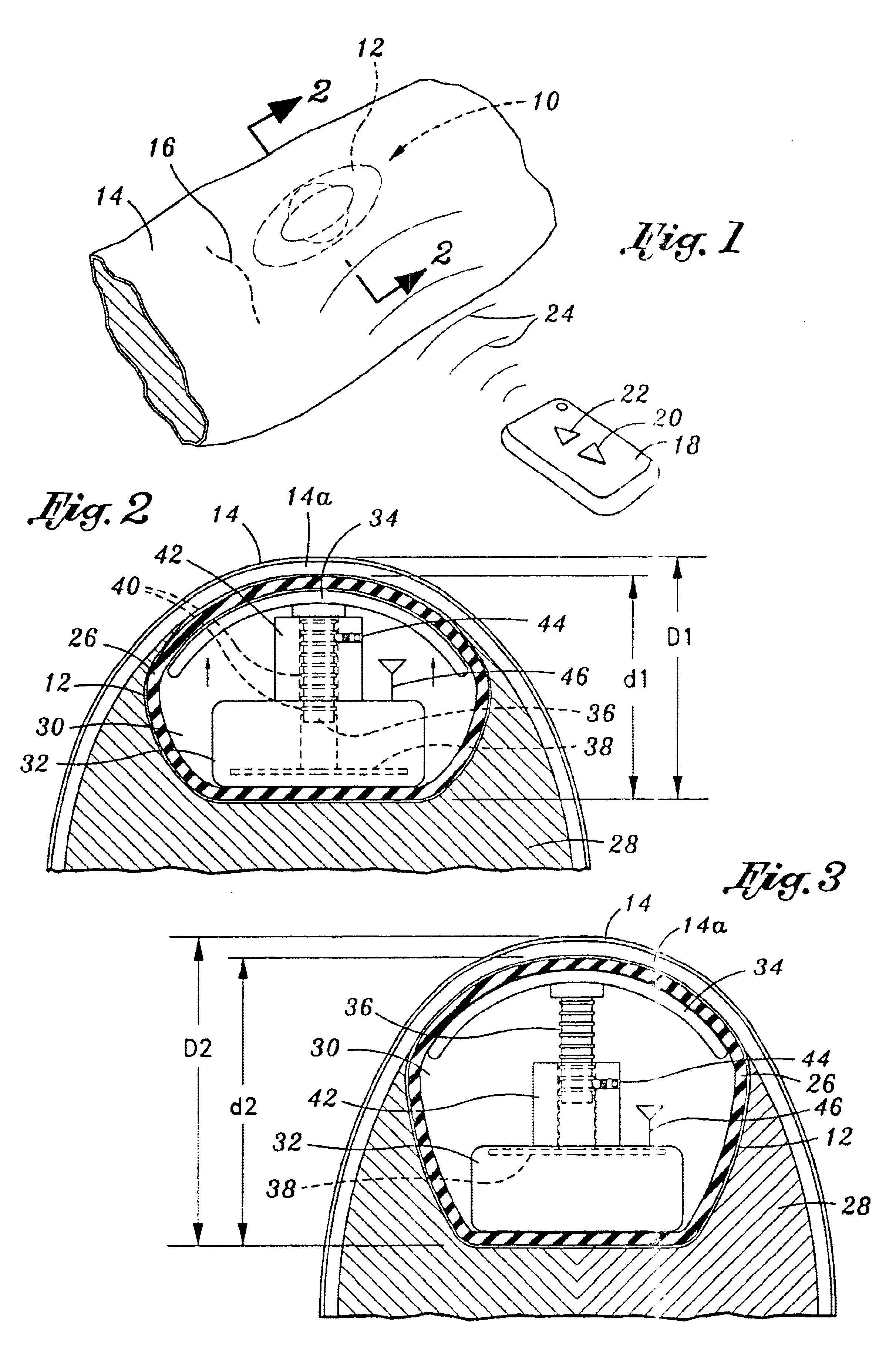 Tissue expander, system and method