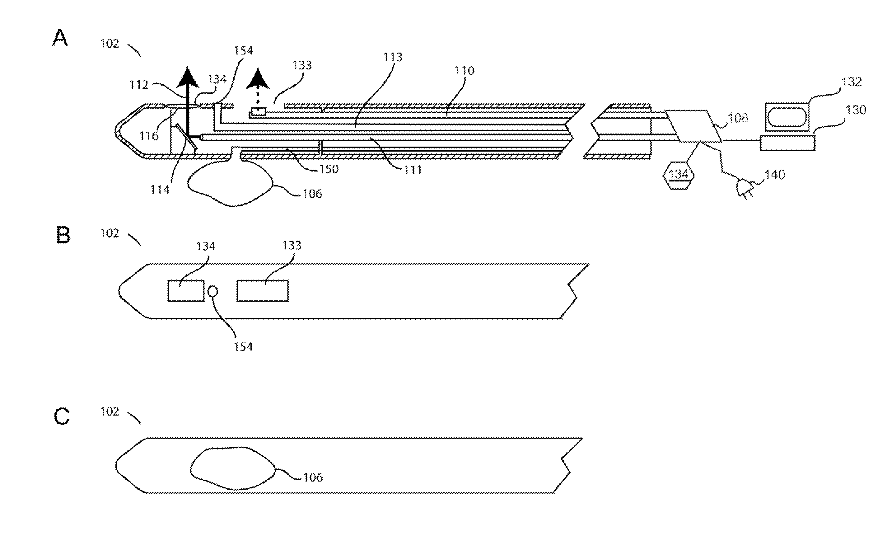 Device for reducing renal sympathetic nerve activity