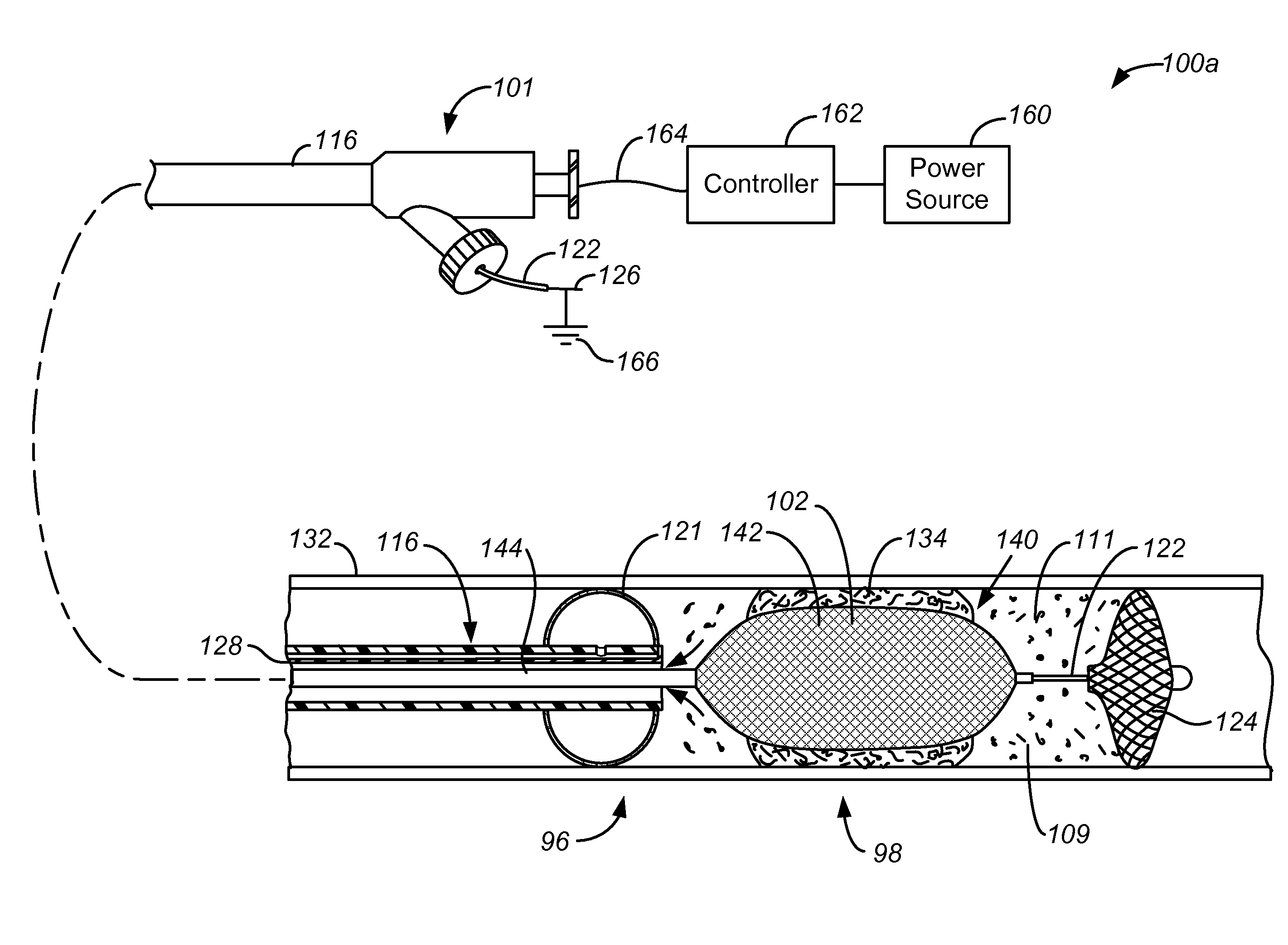 Method for treating a target site in a vascular body channel