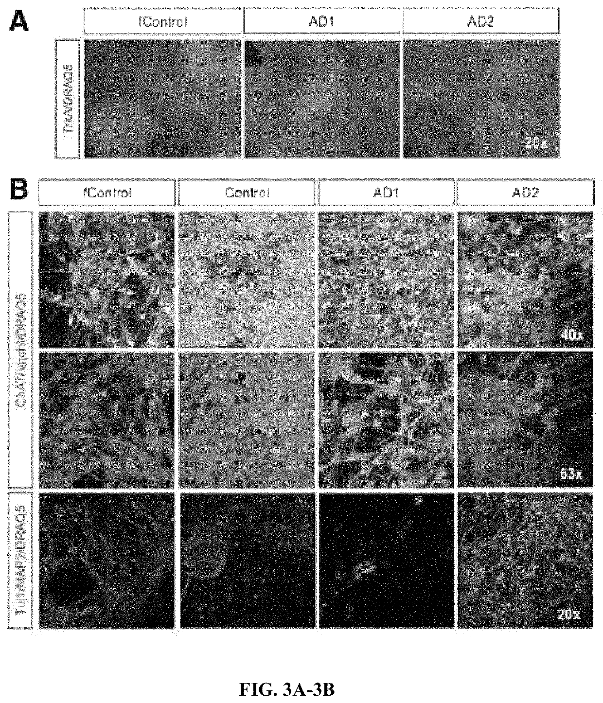 Method and composition for generating basal forebrain cholinergic neurons (BFCNS)