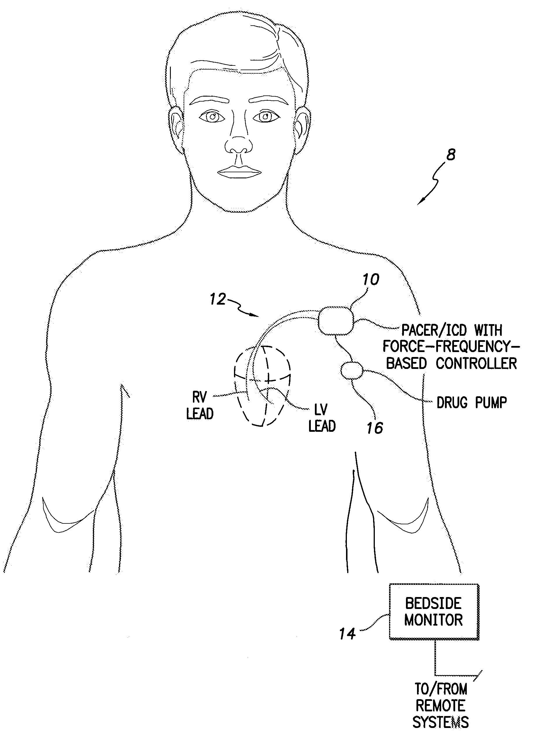 System and method for controlling rate-adaptive pacing based on a cardiac force-frequency relation detected by an implantable medical device