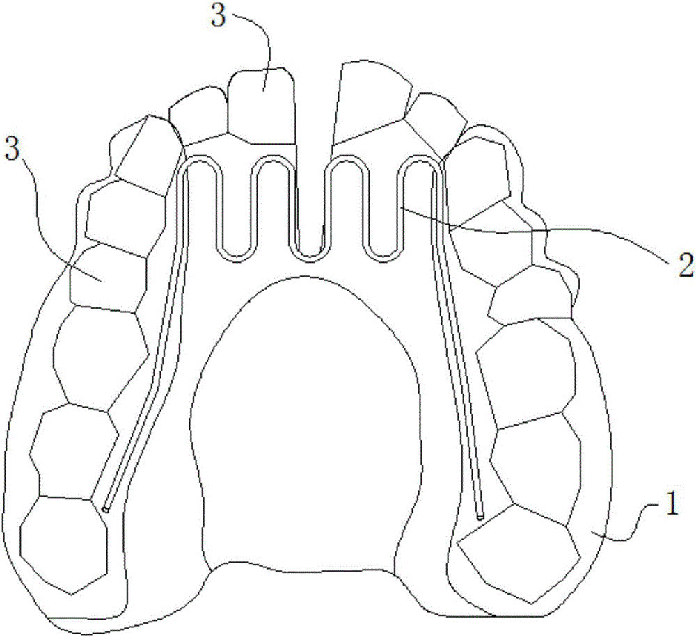 Dental arch expansion device and operation method thereof