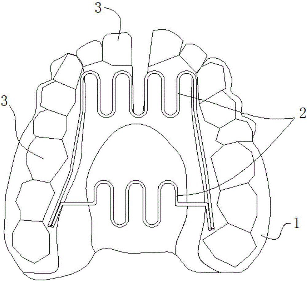 Dental arch expansion device and operation method thereof