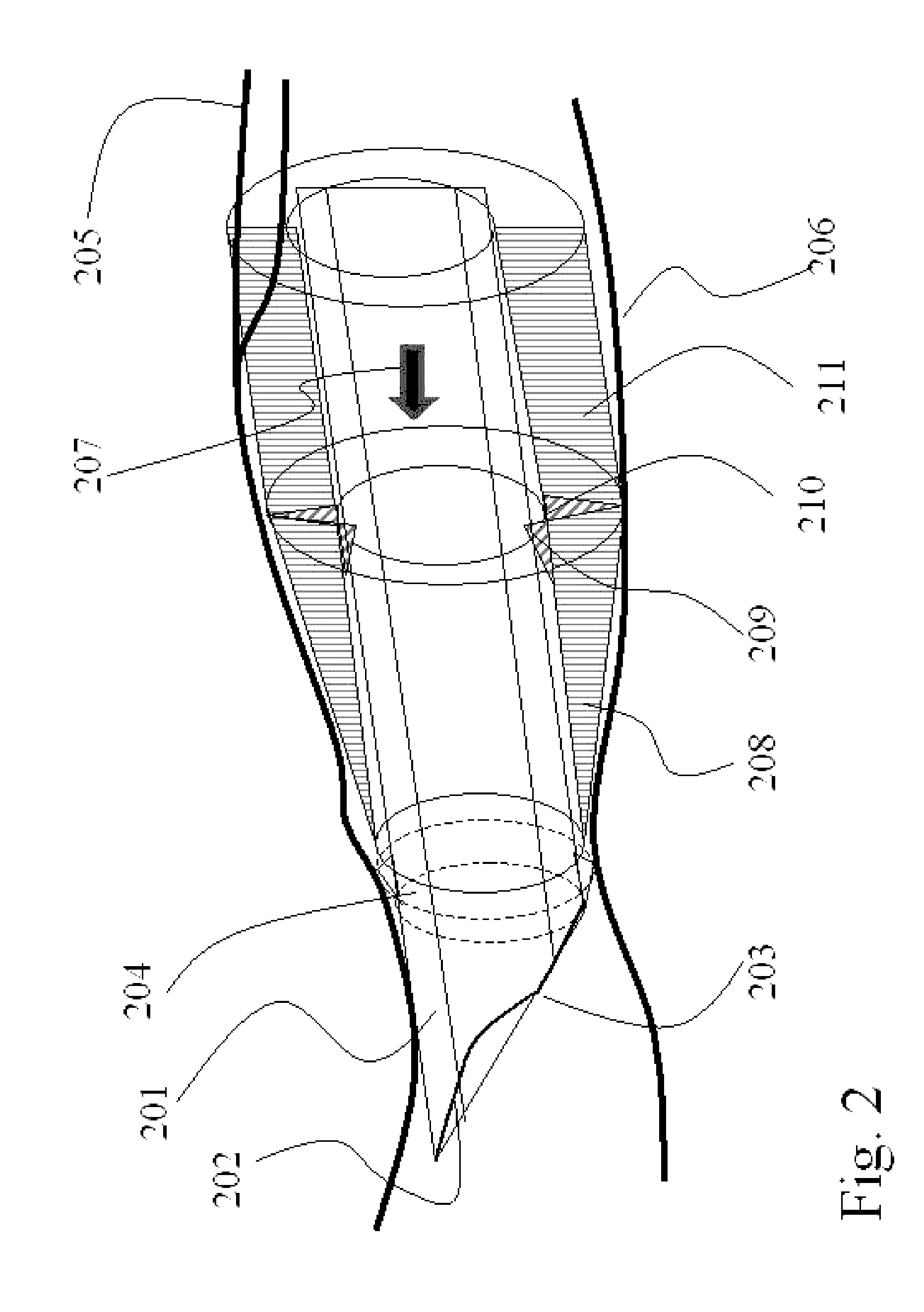 Enhanced cannulation method and needles