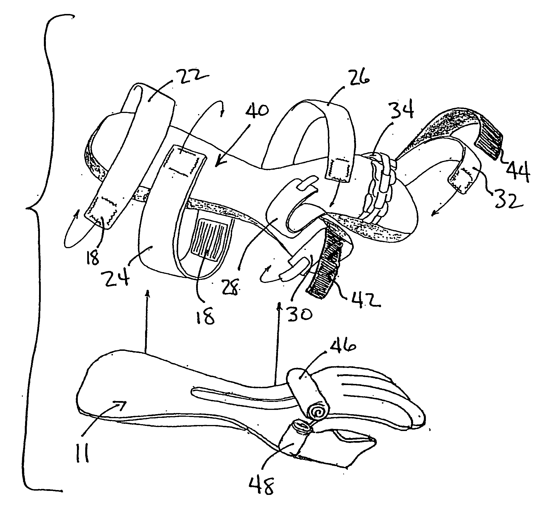 Hand orthosis