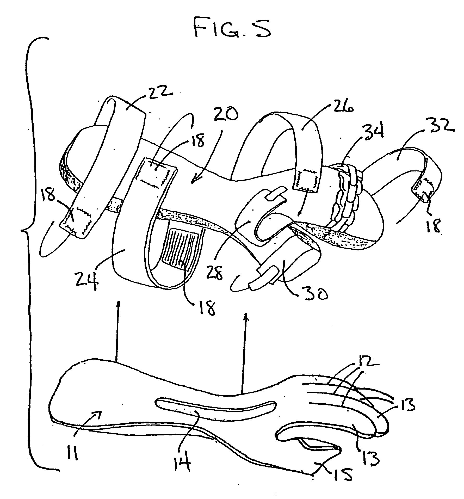 Hand orthosis