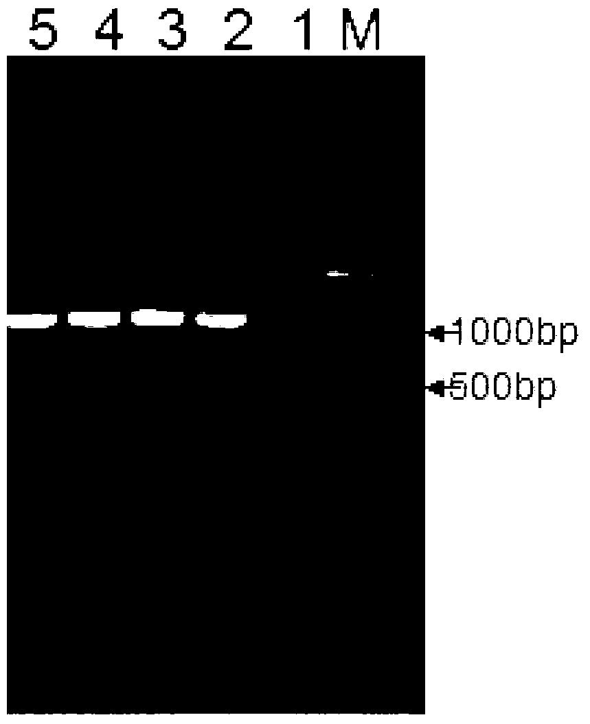 Mycoplasma pneumoniae recombinant antigen, and preparation method and application of mycoplasma pneumoniae recombinant antigen