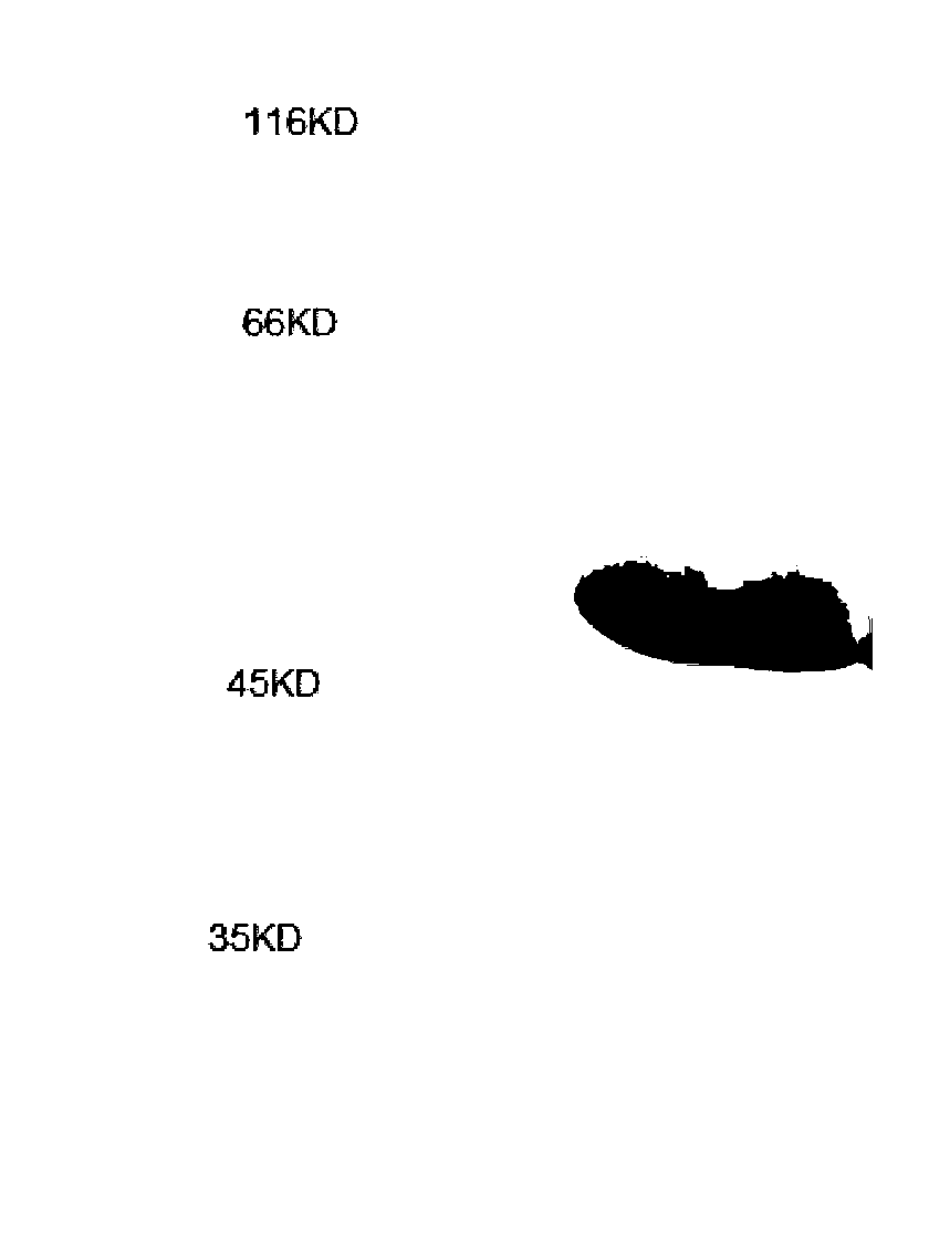 Mycoplasma pneumoniae recombinant antigen, and preparation method and application of mycoplasma pneumoniae recombinant antigen