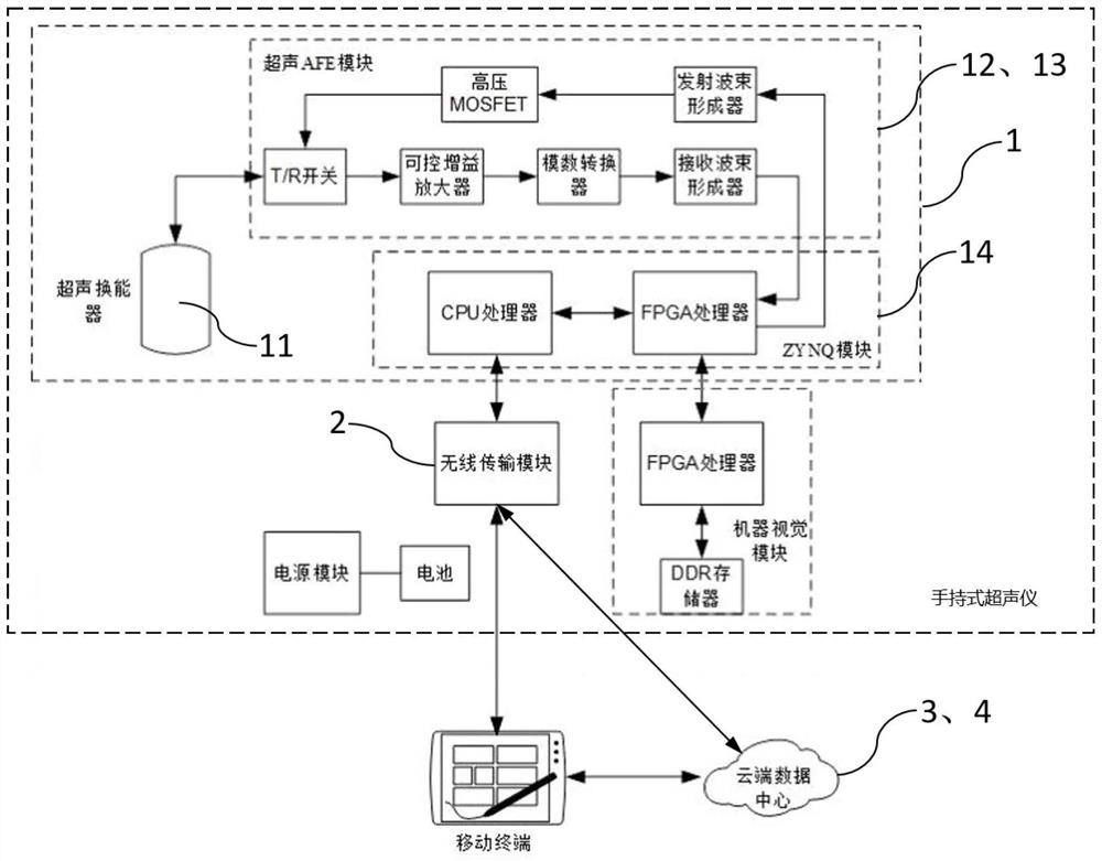 Portable ultrasonic pneumonia auxiliary diagnosis system based on artificial intelligence