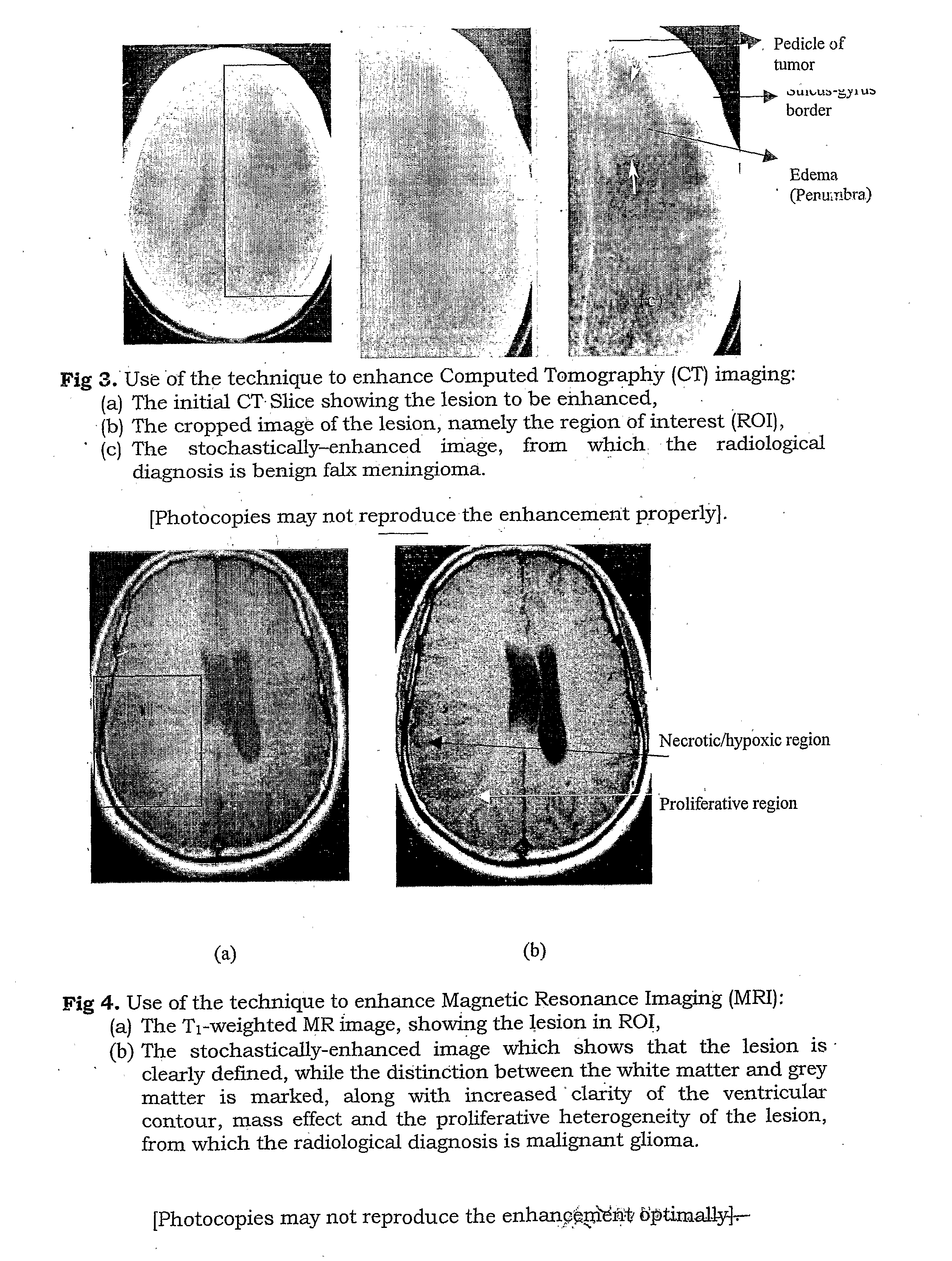 Medical Image Enhancement Technique Based on Image Transform Resonance