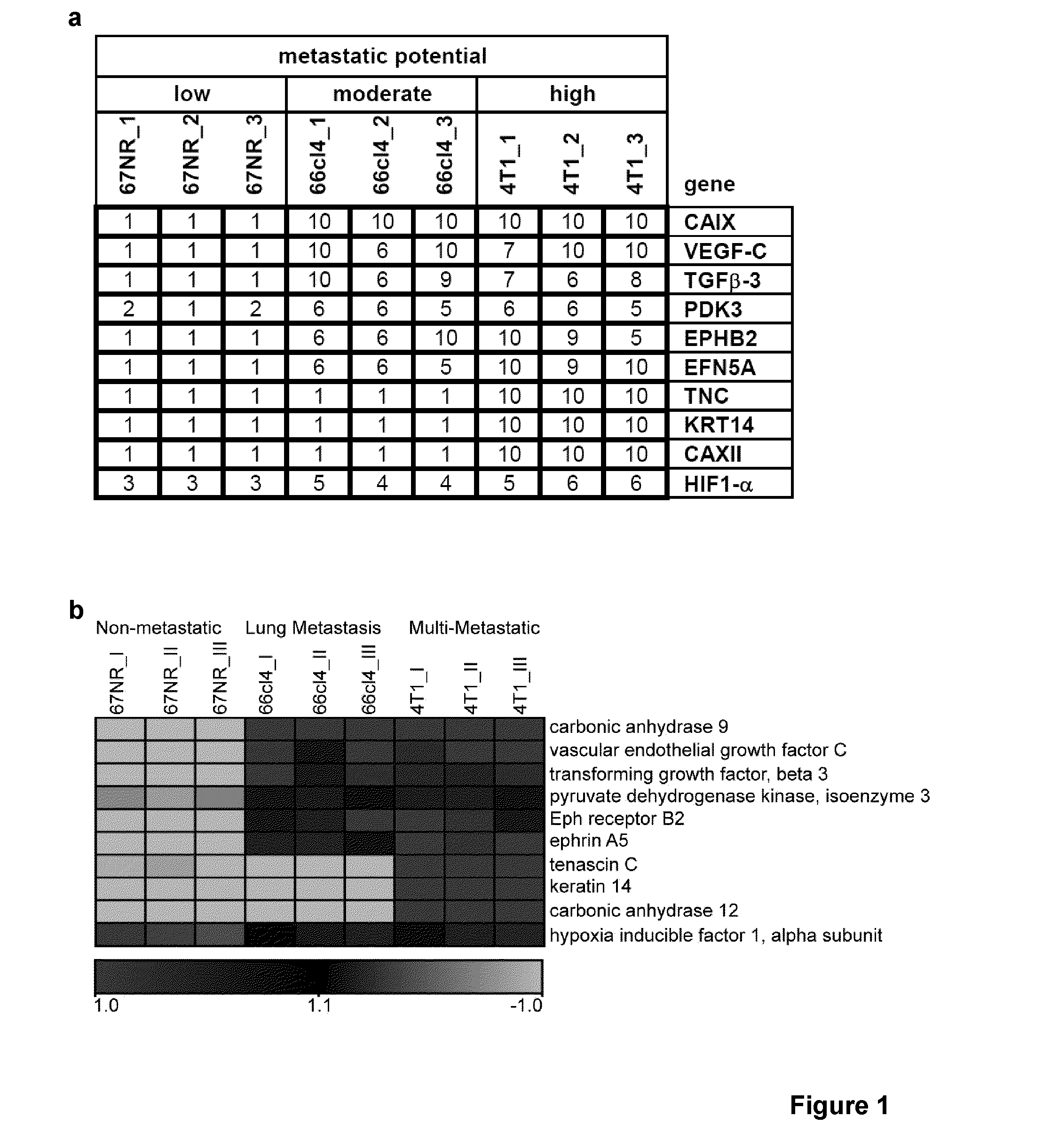 Biomarkers of cancer metastasis