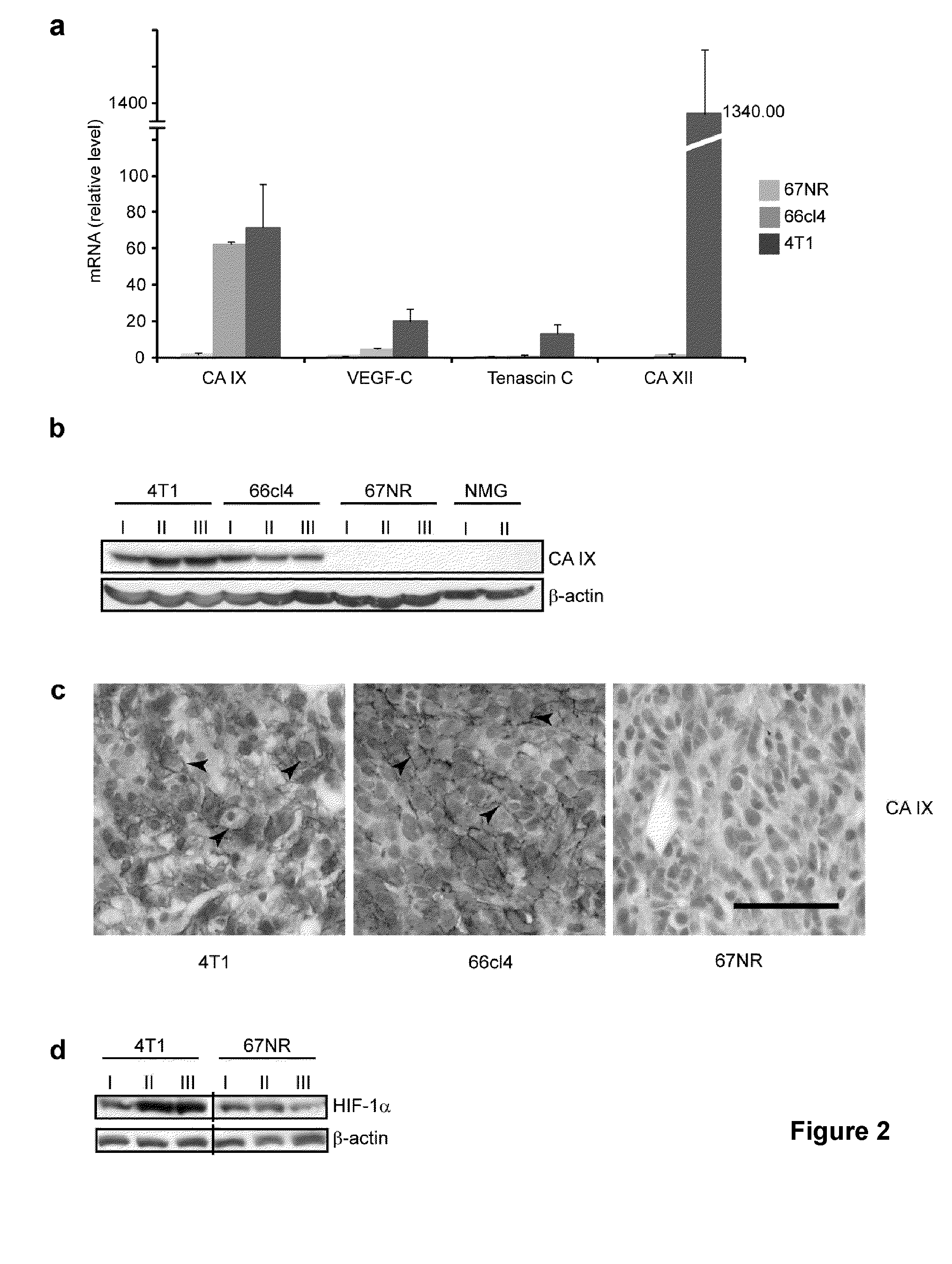 Biomarkers of cancer metastasis