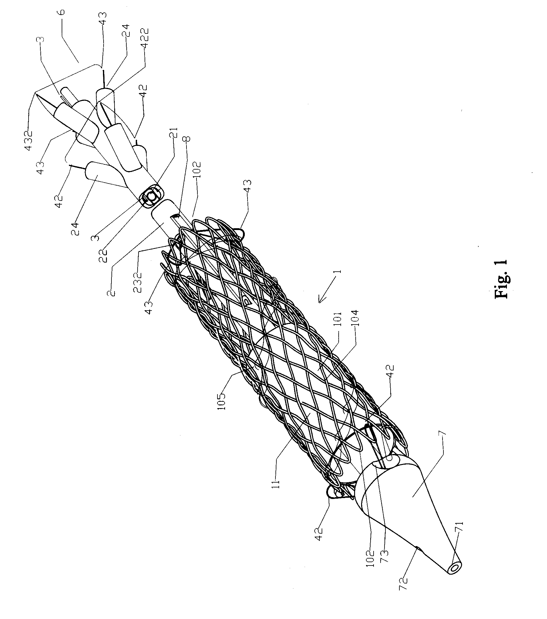 Axial Pullwire Tension Mechanism for Self-Expanding Stent