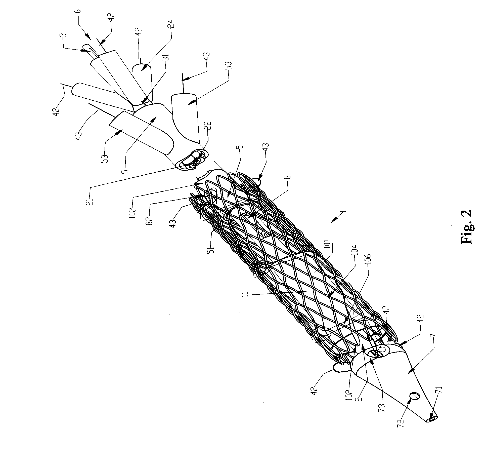 Axial Pullwire Tension Mechanism for Self-Expanding Stent