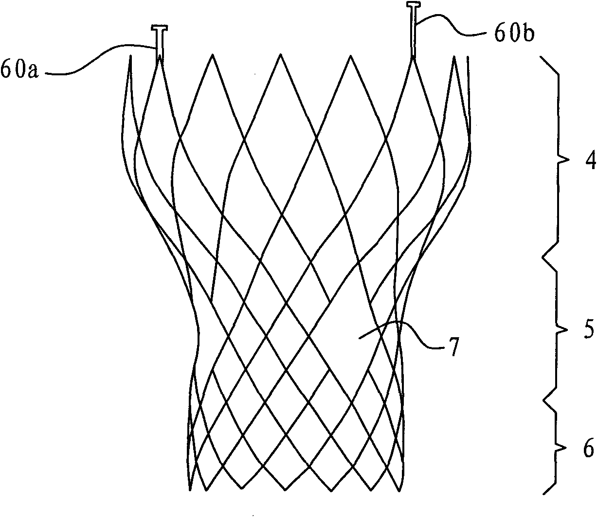 Conveniently-implantable artificial valve replacement device and scaffold