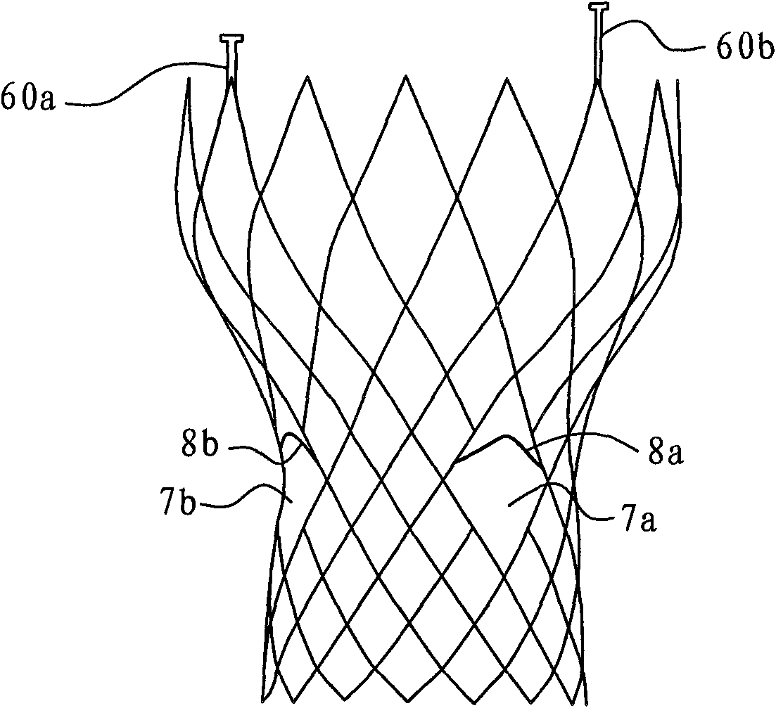 Conveniently-implantable artificial valve replacement device and scaffold