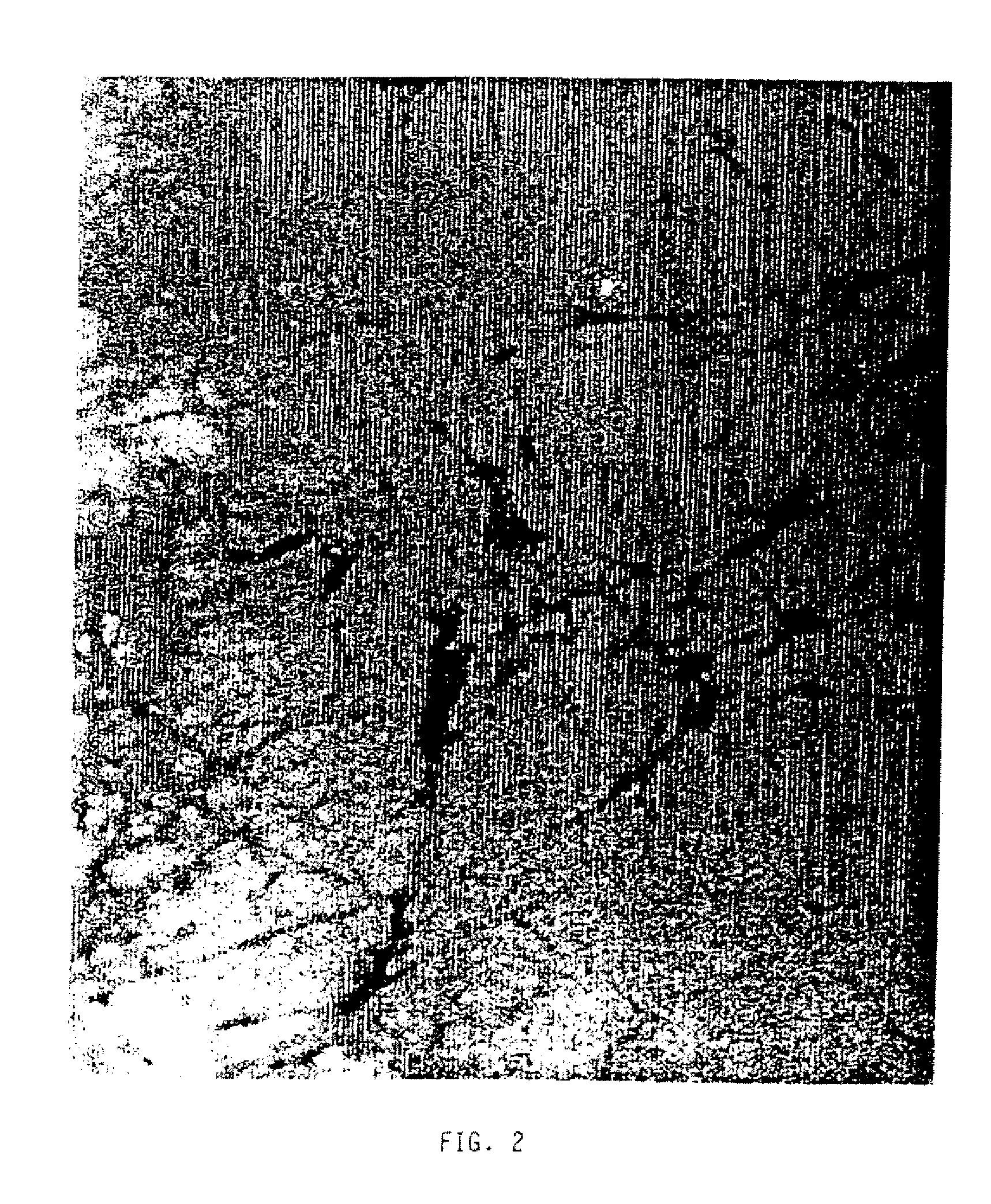 Composite materials comprised of calcium compounds and protein components