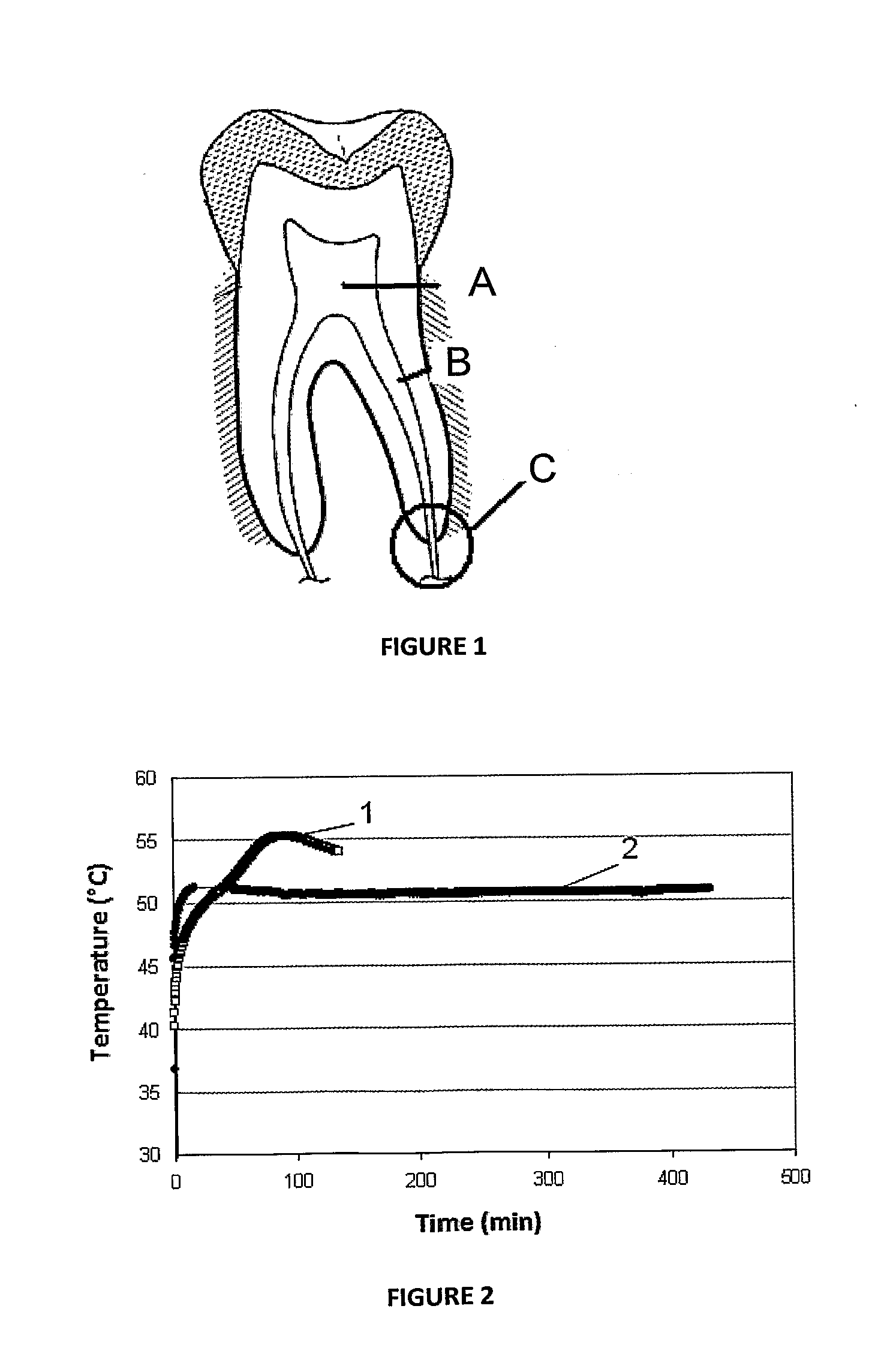 Aluminous cement-based composition for application in endodontics and cementitious product obtained thereof