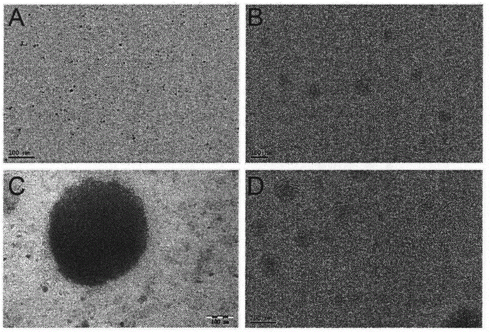 Method for preparing shrapnel type anti-tumor gold nano conjugate heterozygous liposome and application thereof