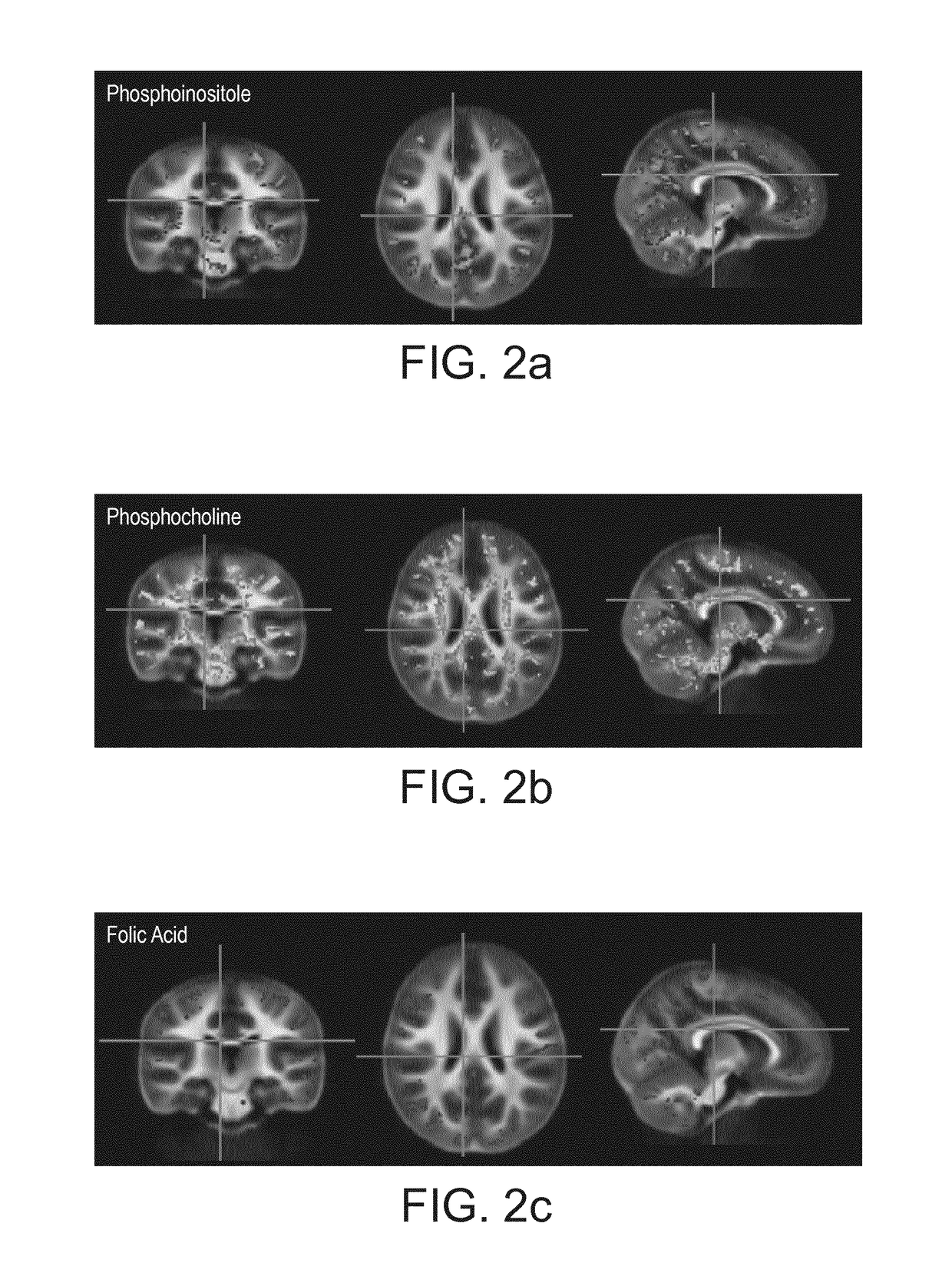 Nutritional composition and infant formula for promoting de novo myelination