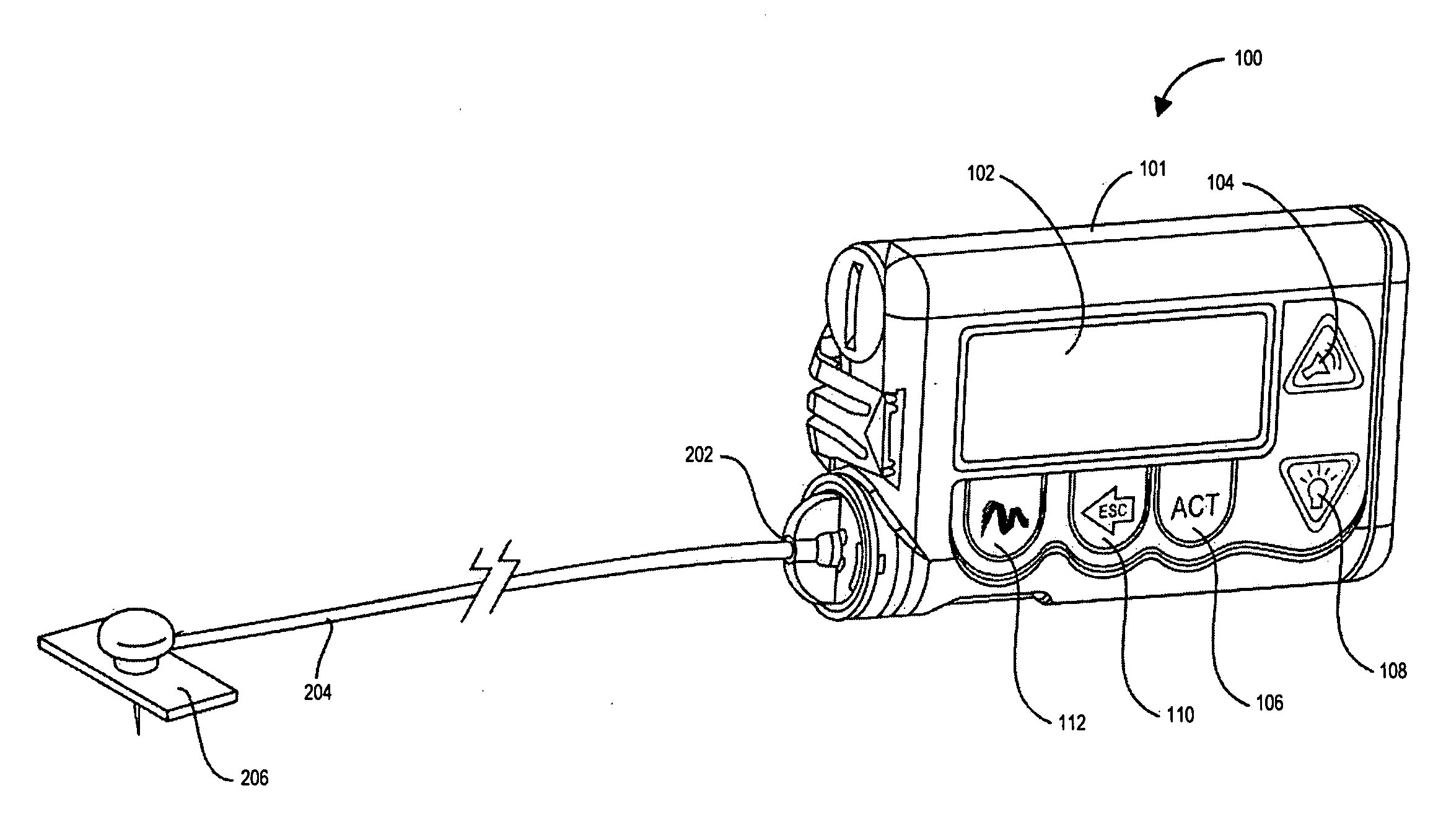 Methods and apparatuses for detecting medical device acceleration, temperature, and humidity conditions