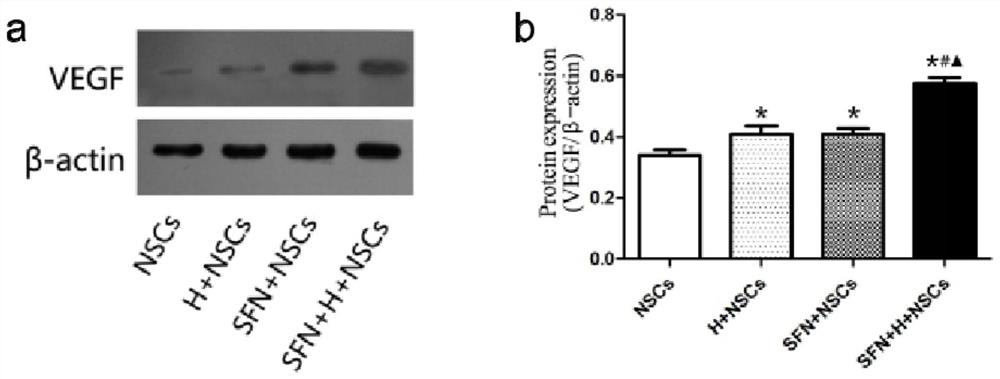 Hydrogel/fibroin nanofiber/neural stem cell integrated transplant for promoting VEGF secretion as well as preparation method and application thereof