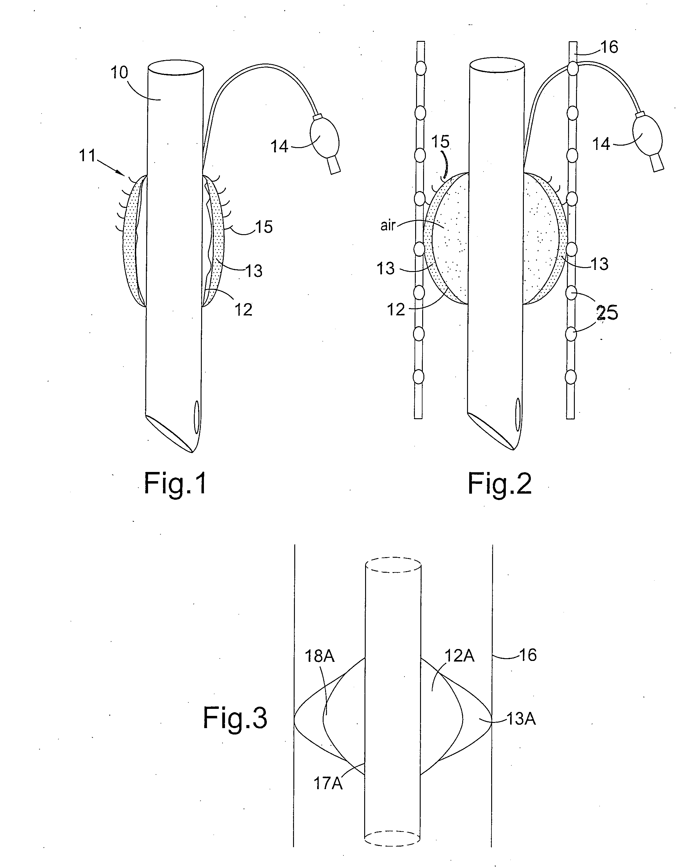 Airway device