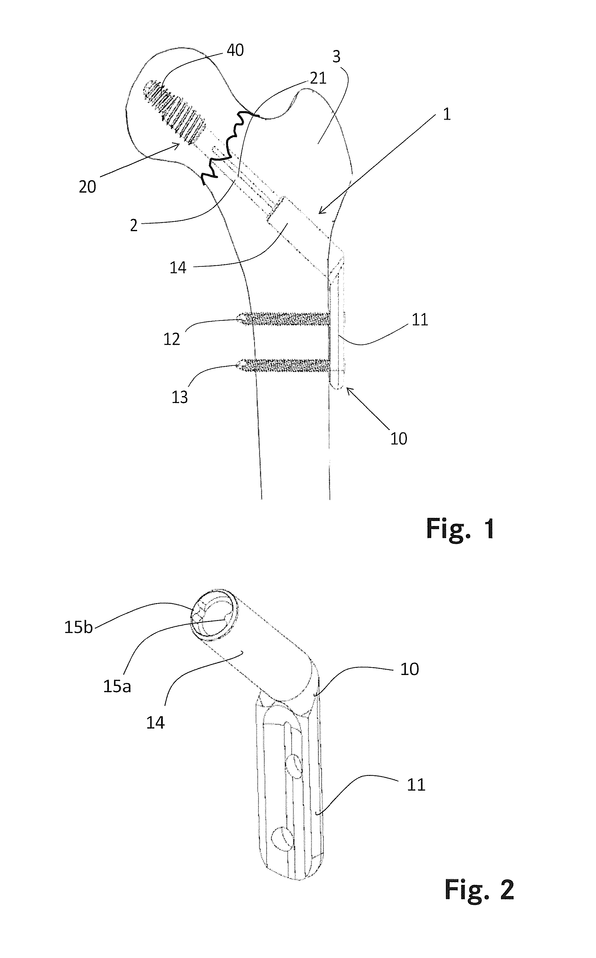 Bone screw assembly