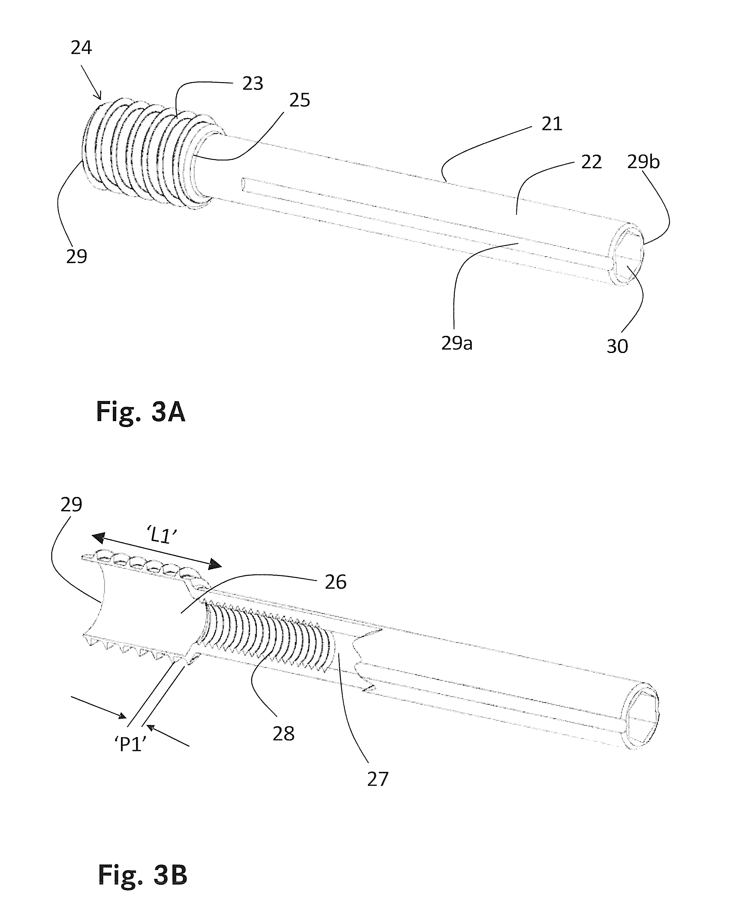 Bone screw assembly