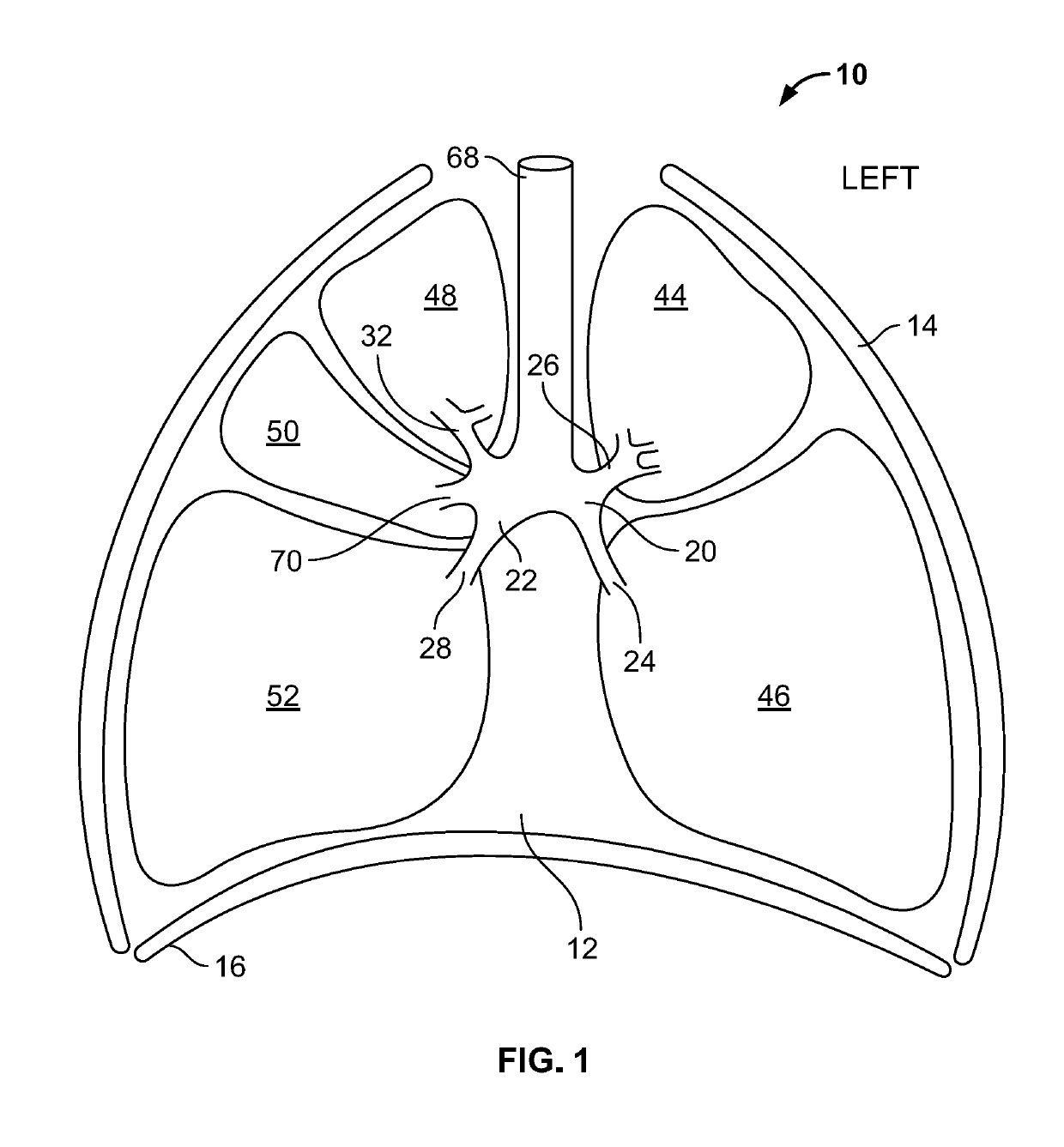 Method for treating emphysema with condensable thermal vapor