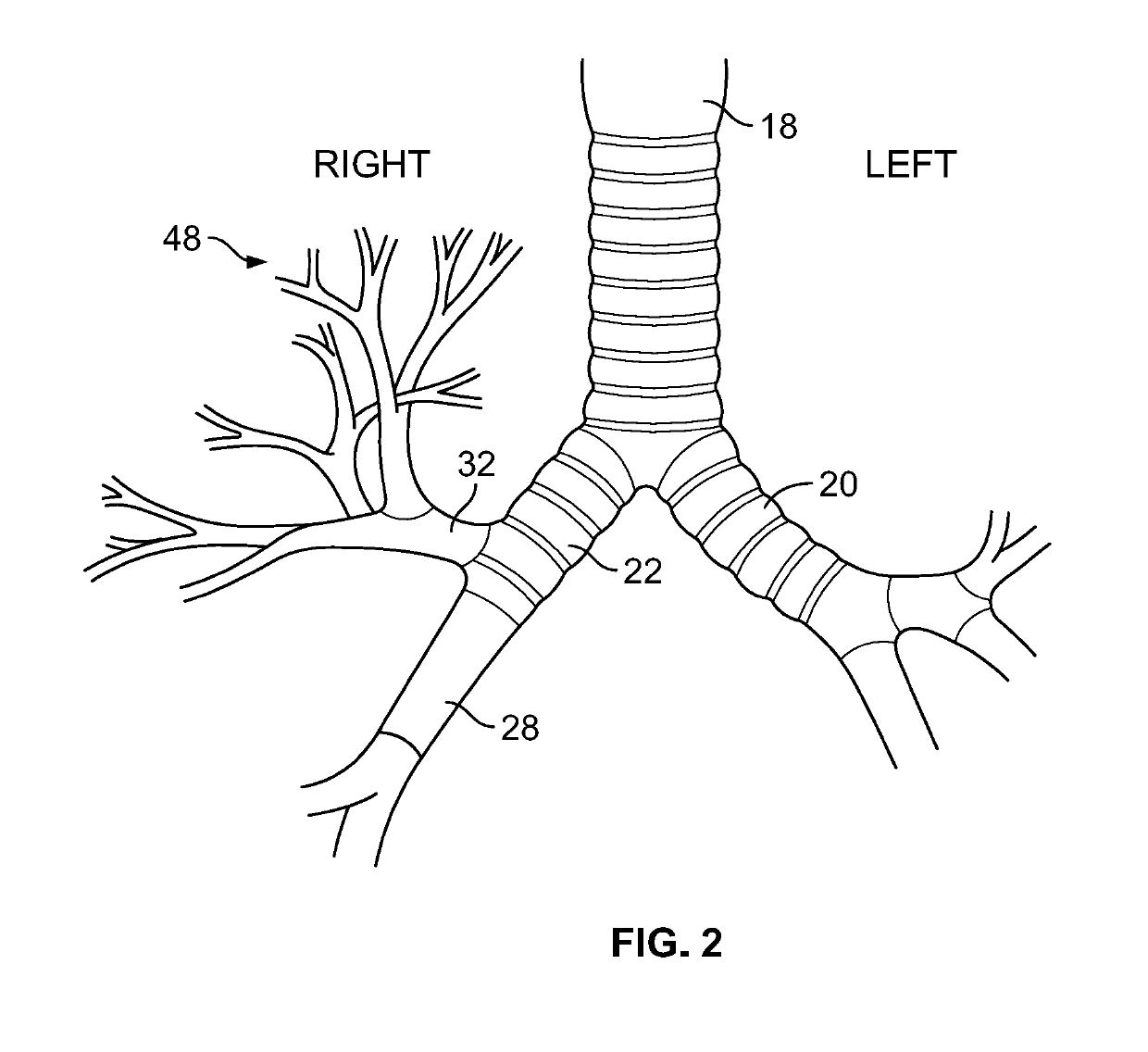 Method for treating emphysema with condensable thermal vapor