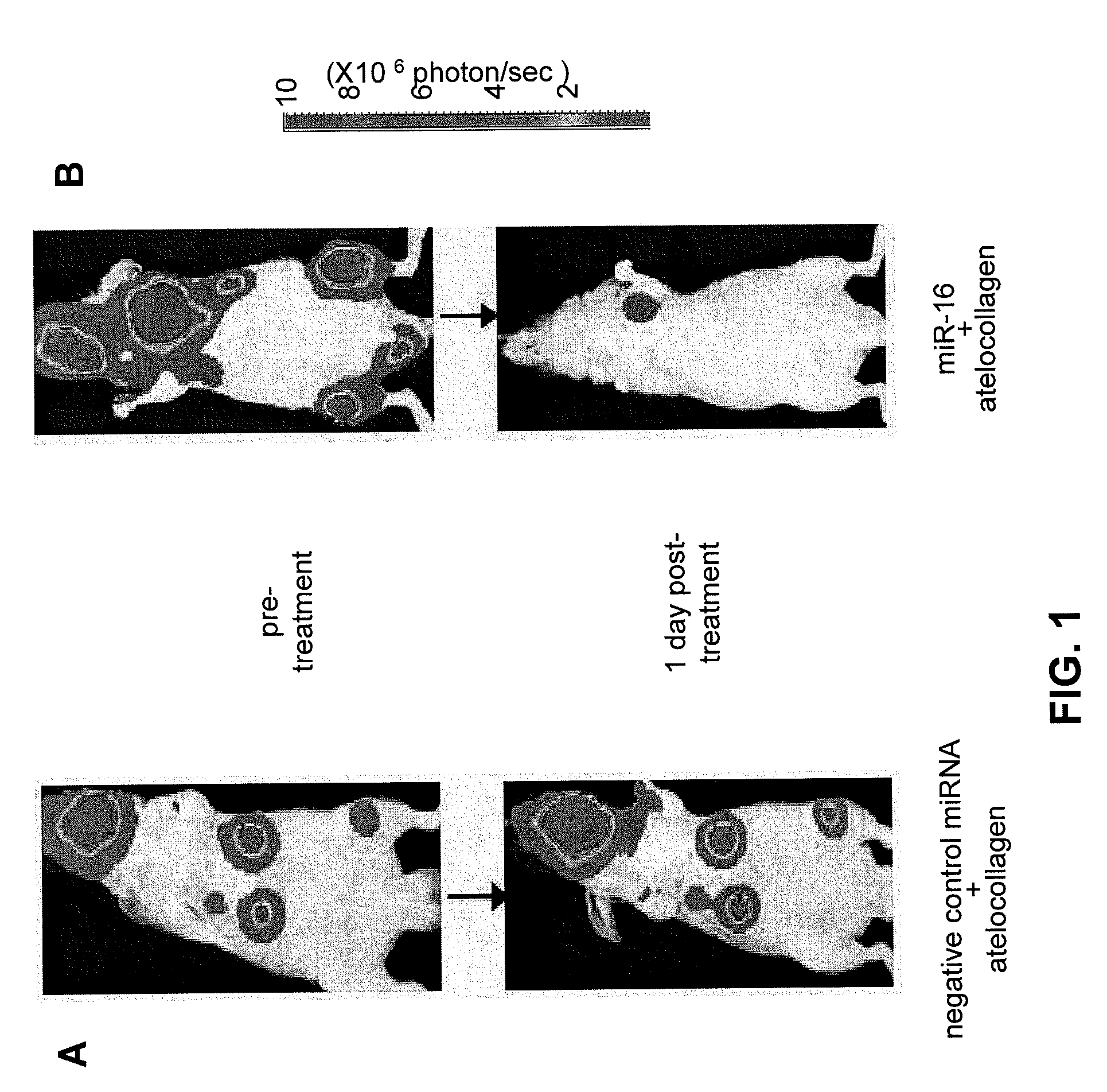 COMPOSITIONS AND METHODS RELATED TO miR-16 AND THERAPY OF PROSTATE CANCER