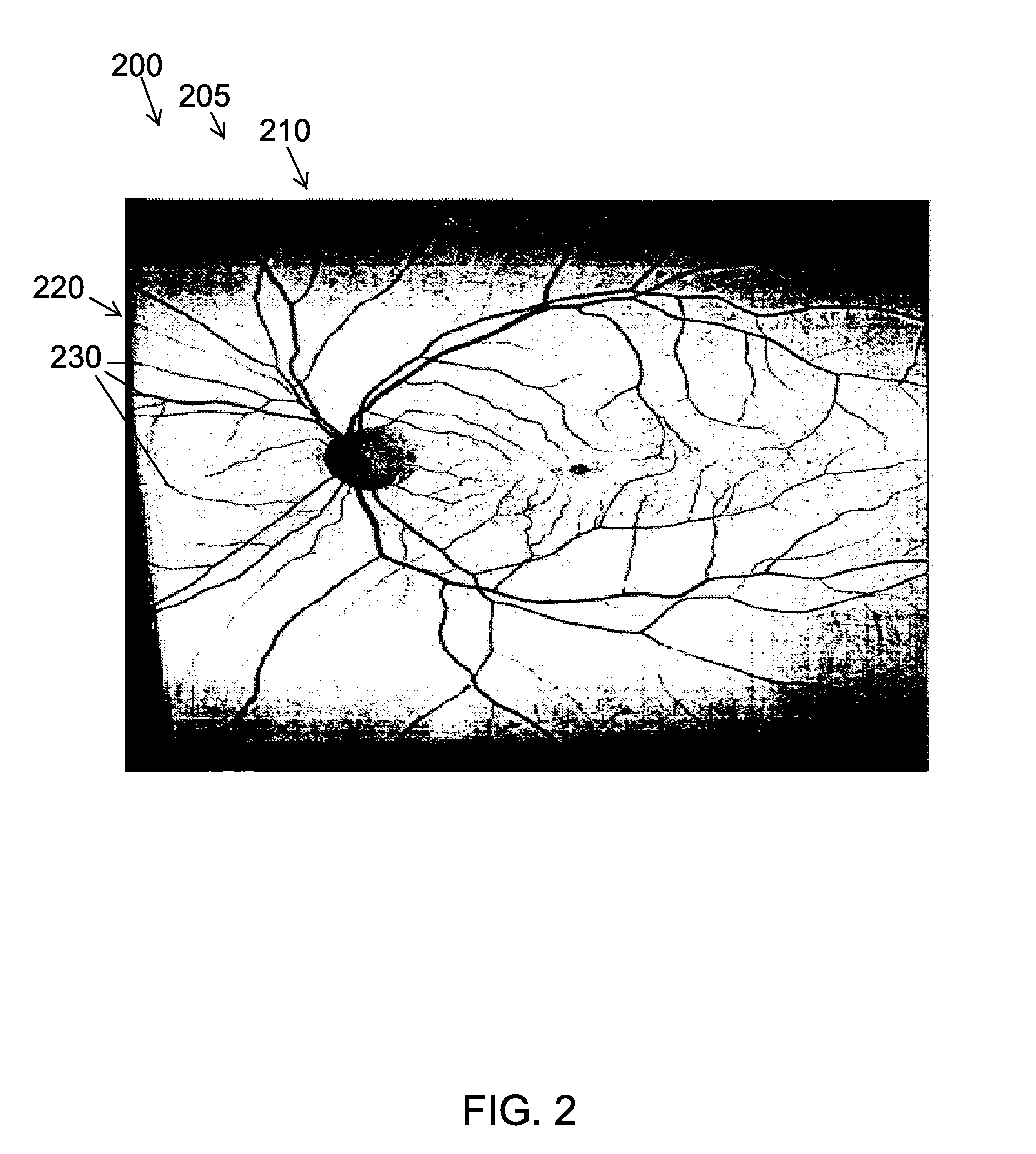 System and method for imaging a patient user's body part