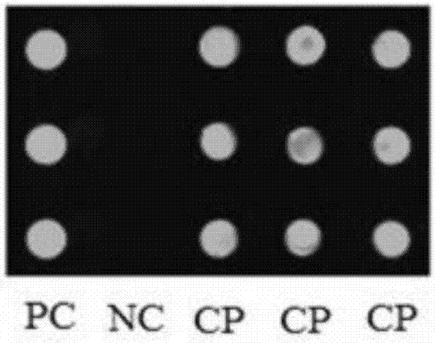 Preparation method for biological chip for detecting food-borne pathogenic bacteria