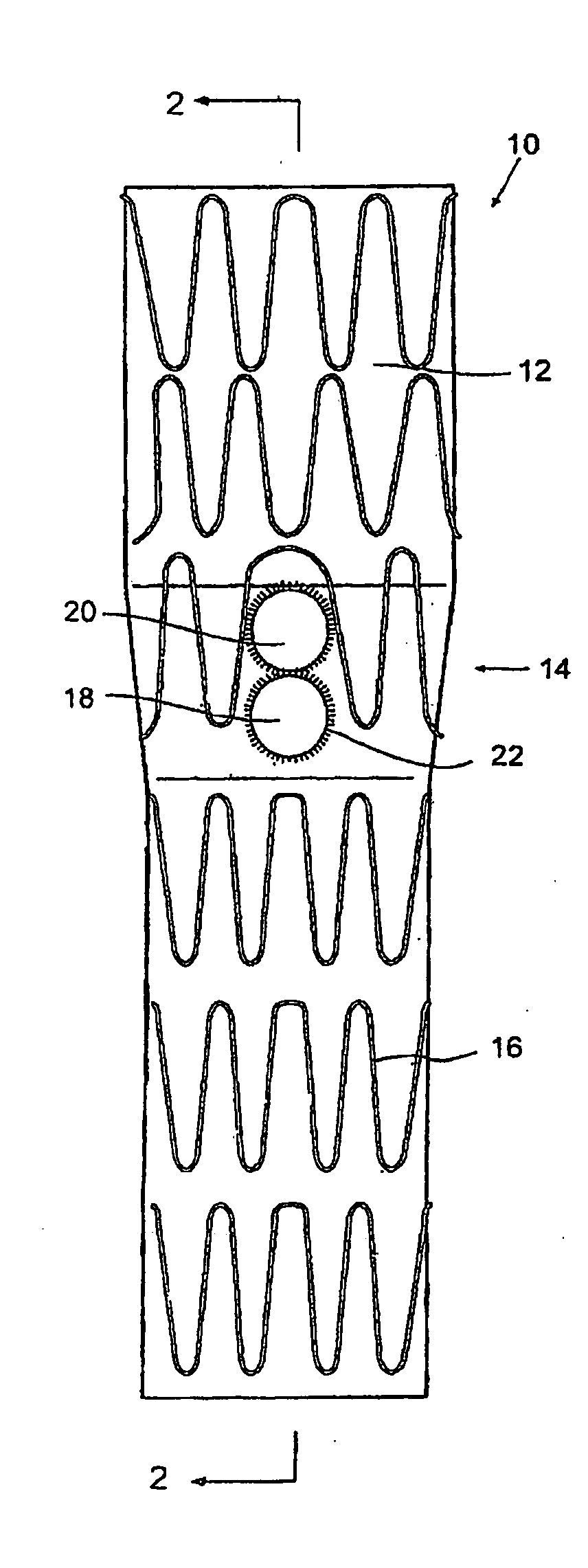 Stent graft