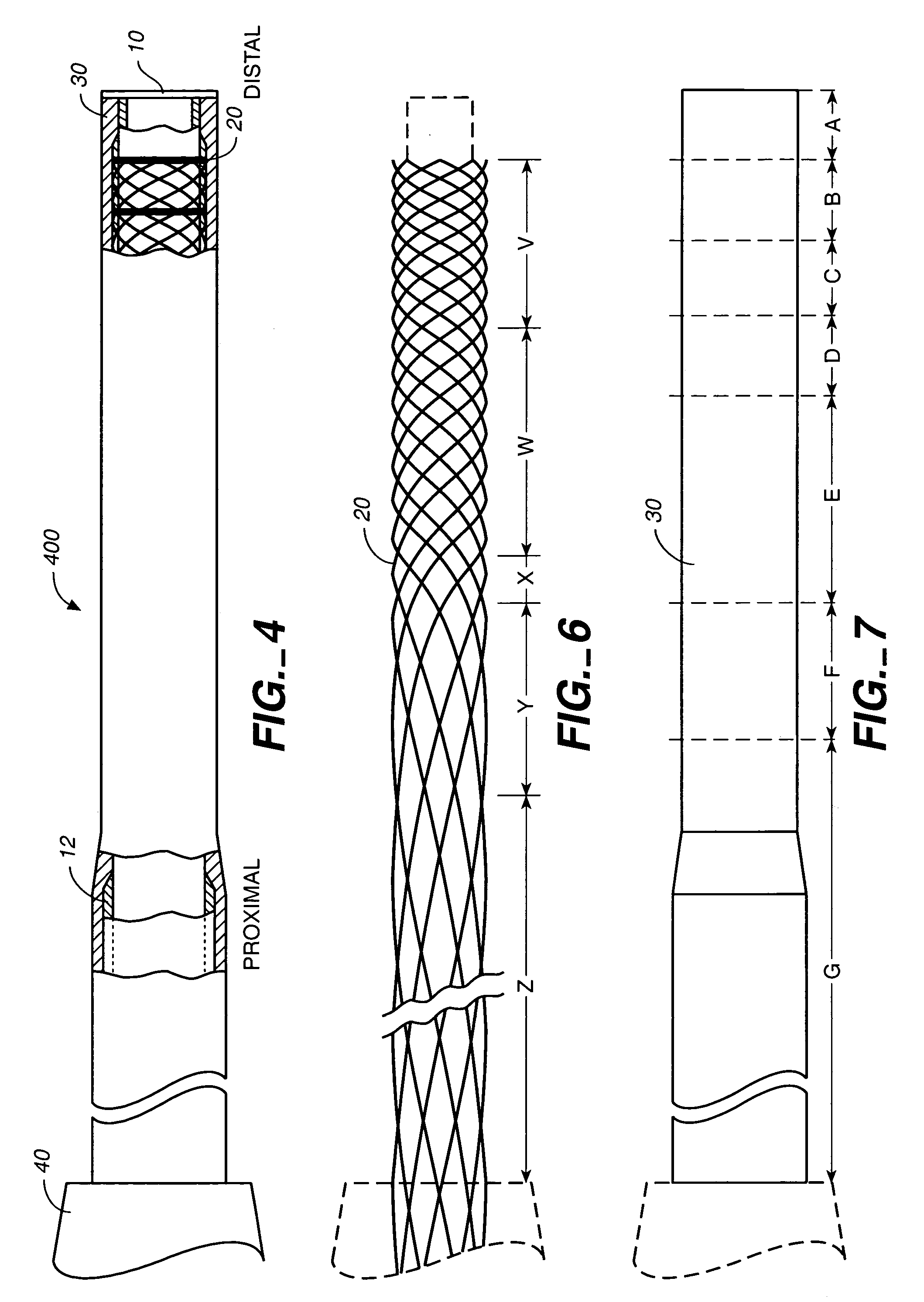 Wire braid-reinforced microcatheter