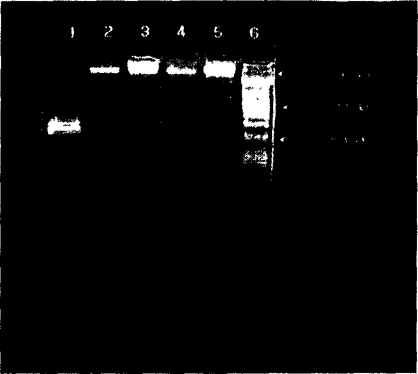 Method of expressing thymys peptide alpha by yeast and use thereof