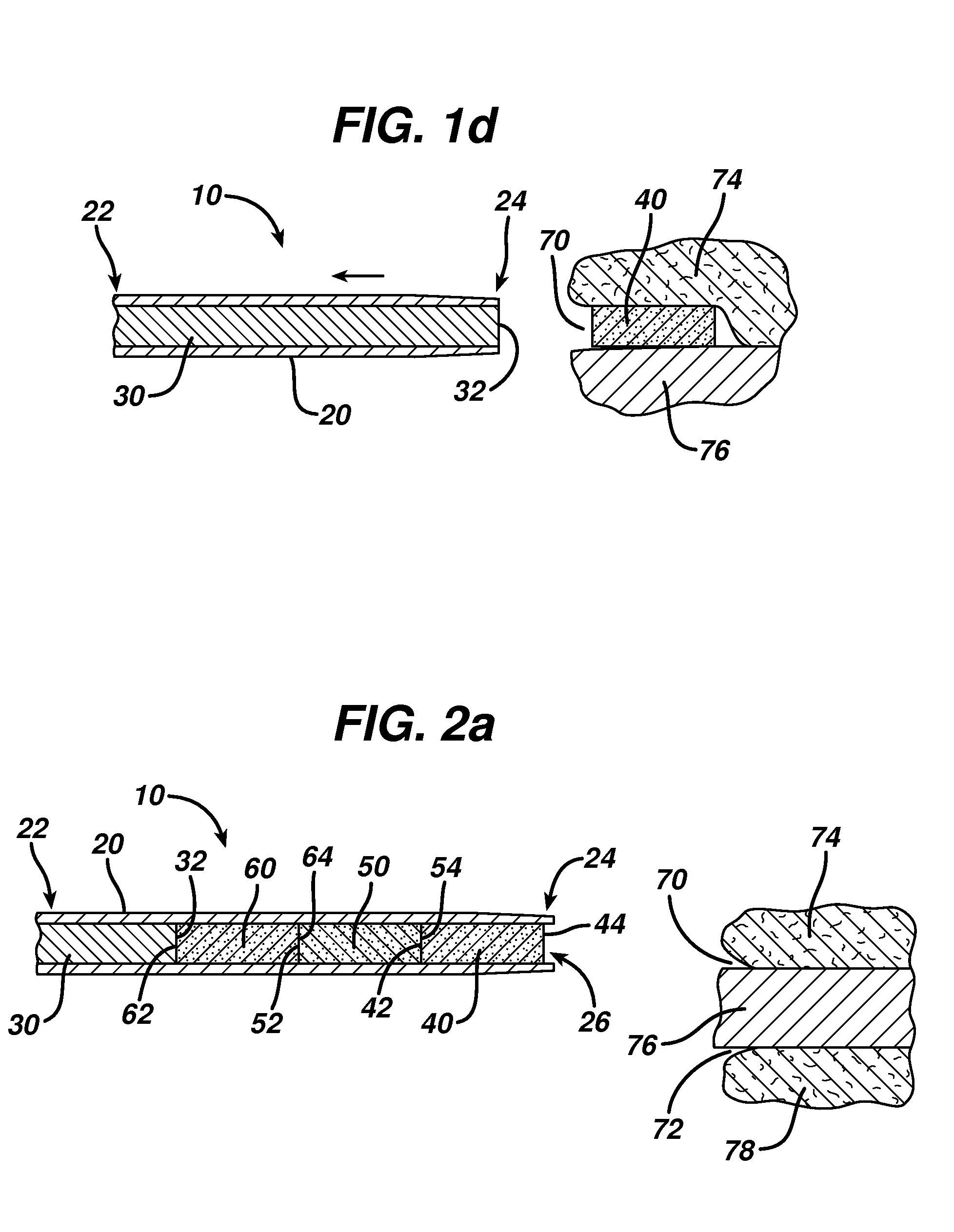 Device for delivering medicinal implants