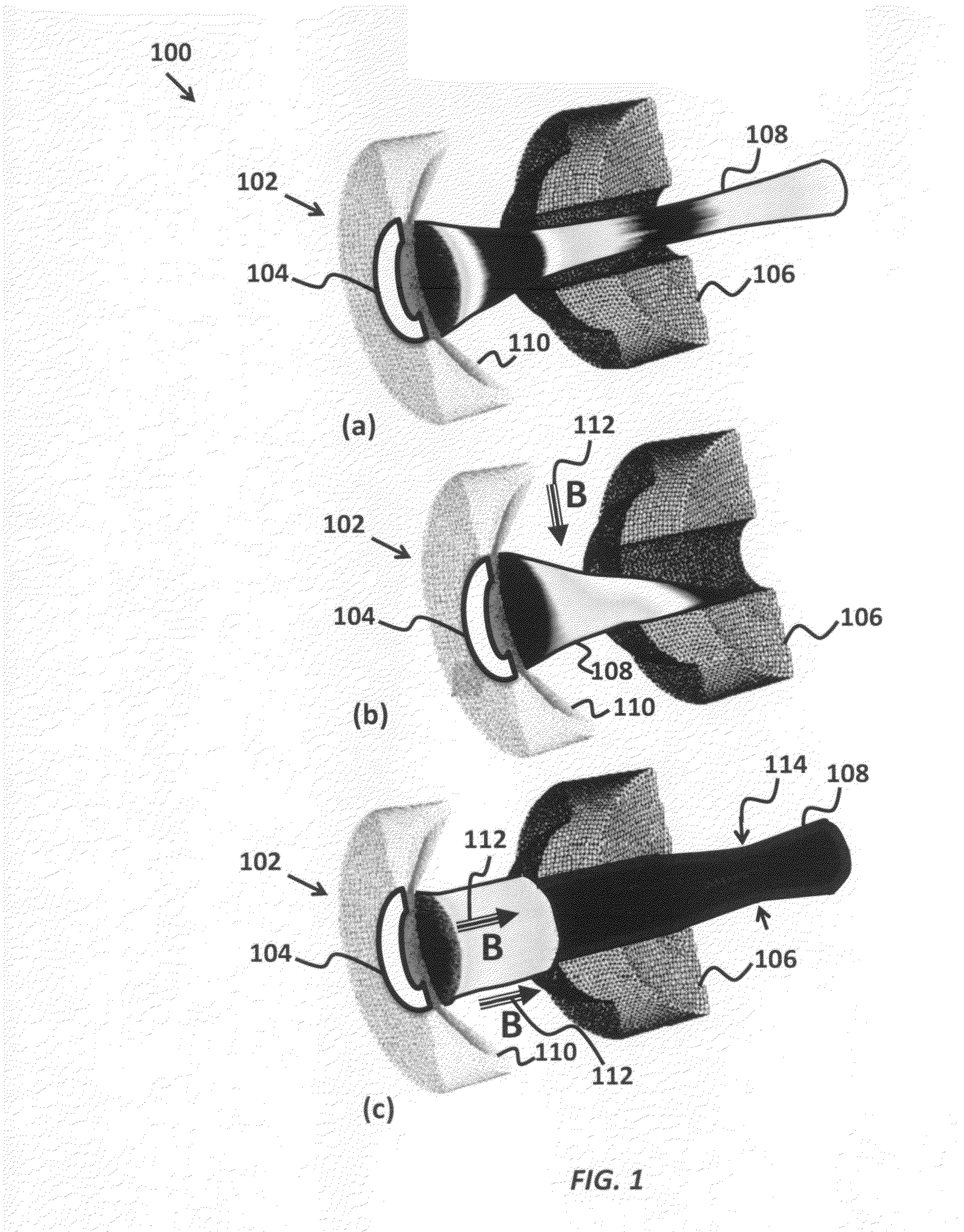 Configurations for integrated MRI-linear accelerators