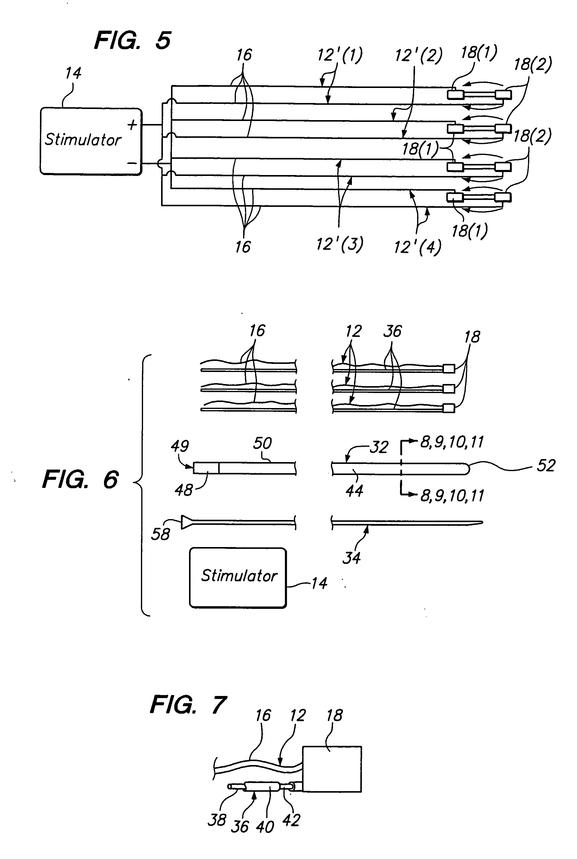 Method of intravascularly delivering stimulation leads into direct contact with tissue