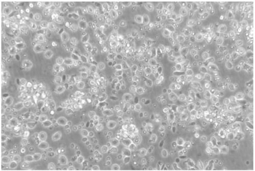 Method for separating and primary culture of grass carp dendritic cells