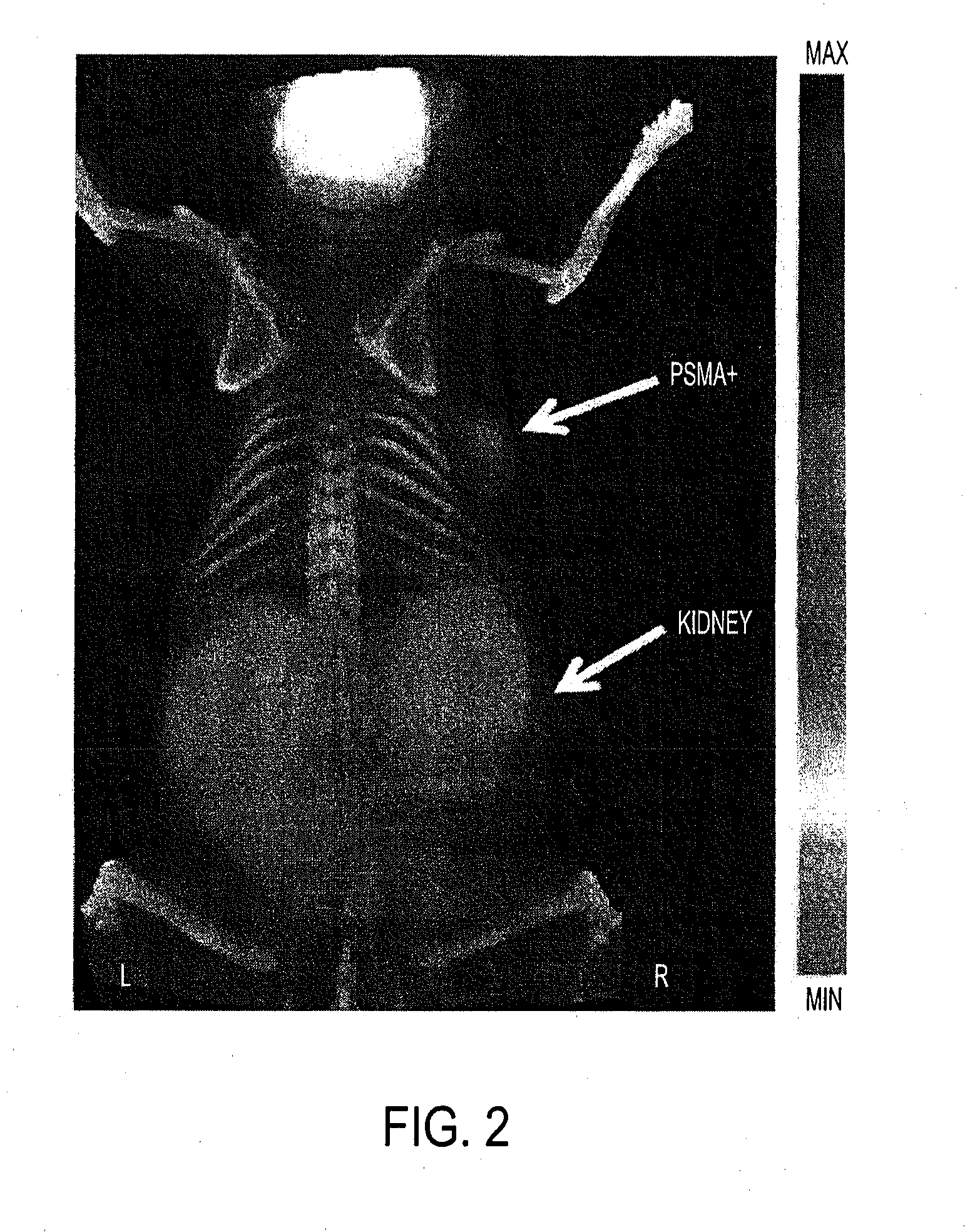 Psma-targeting compounds and uses thereof