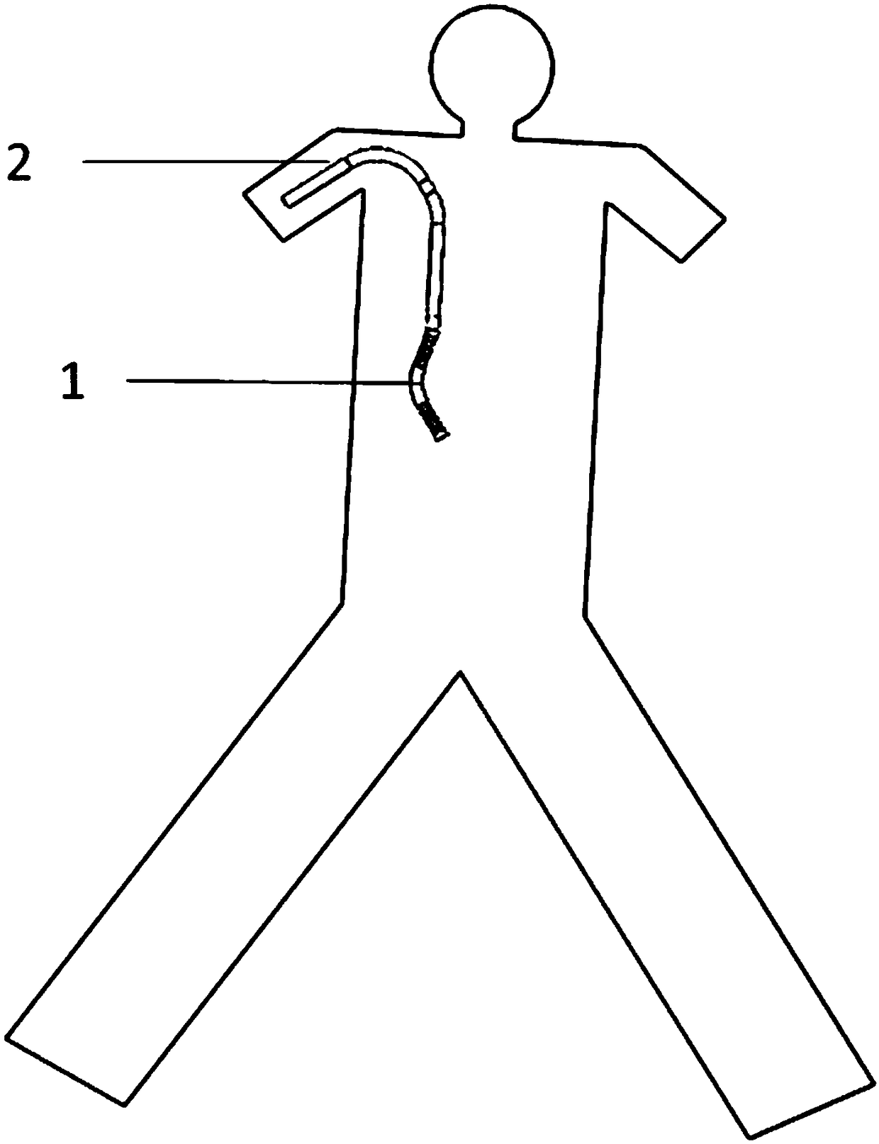 Recoverable transjugular portosystemic shunt thrombolysis catheter