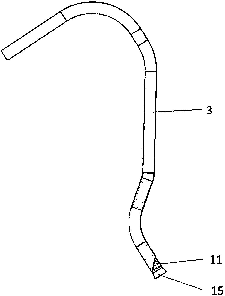 Recoverable transjugular portosystemic shunt thrombolysis catheter