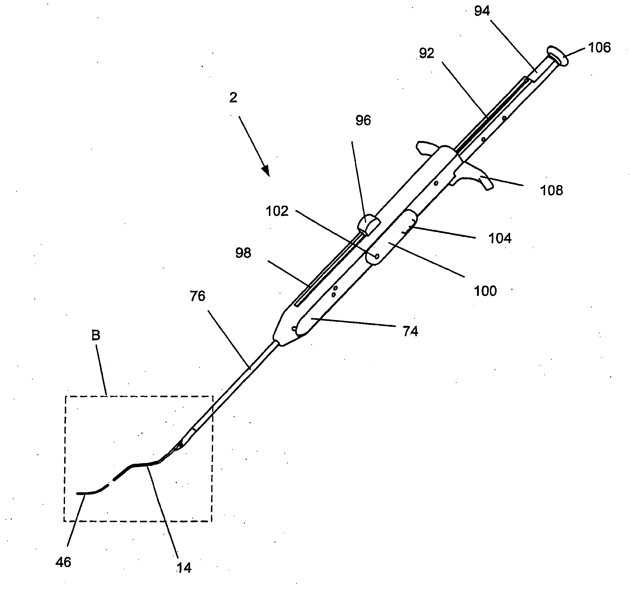 Access and closure device and method