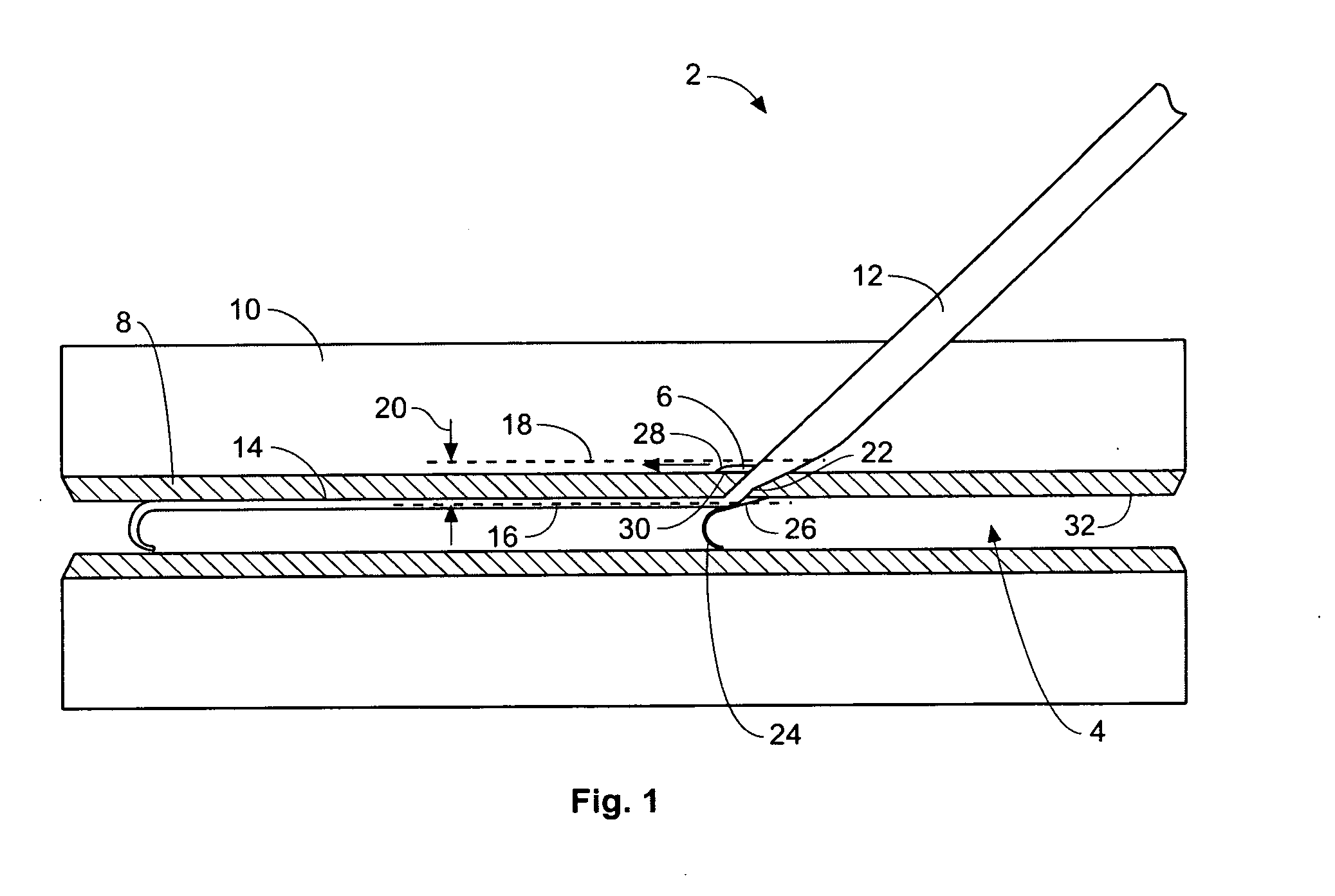 Access and closure device and method